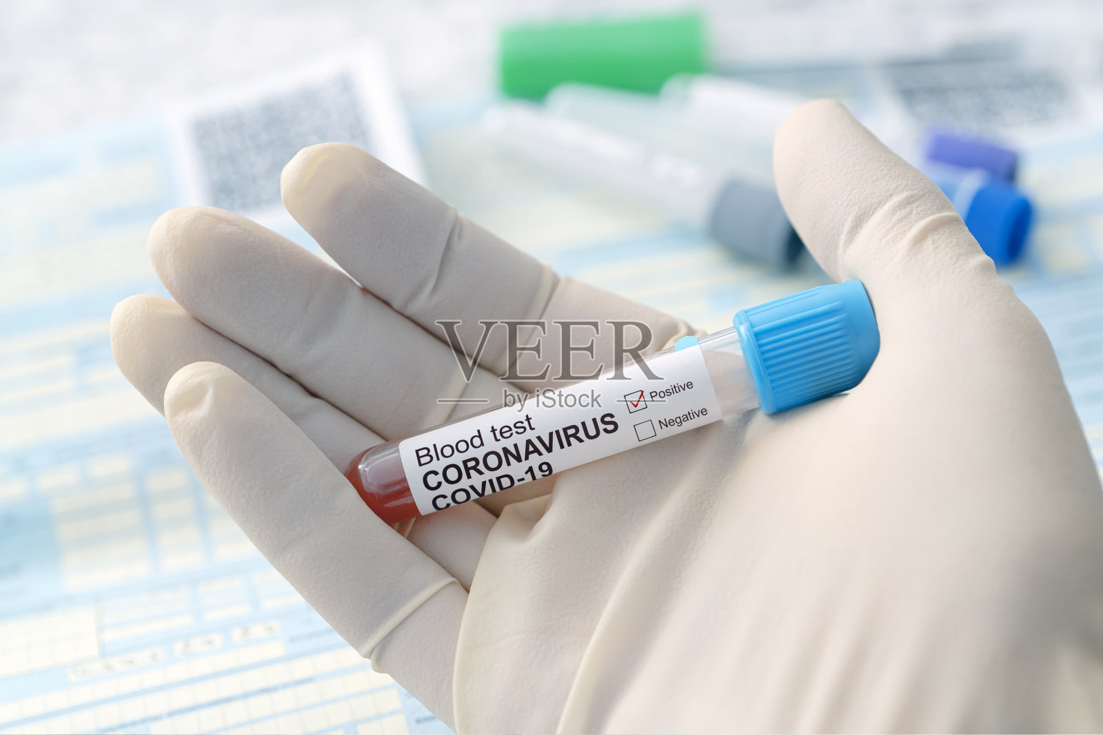 冠状病毒血液检测的概念。医生手持医用手套，将装有冠状病毒阳性血液的试管放在实验桌上。照片摄影图片