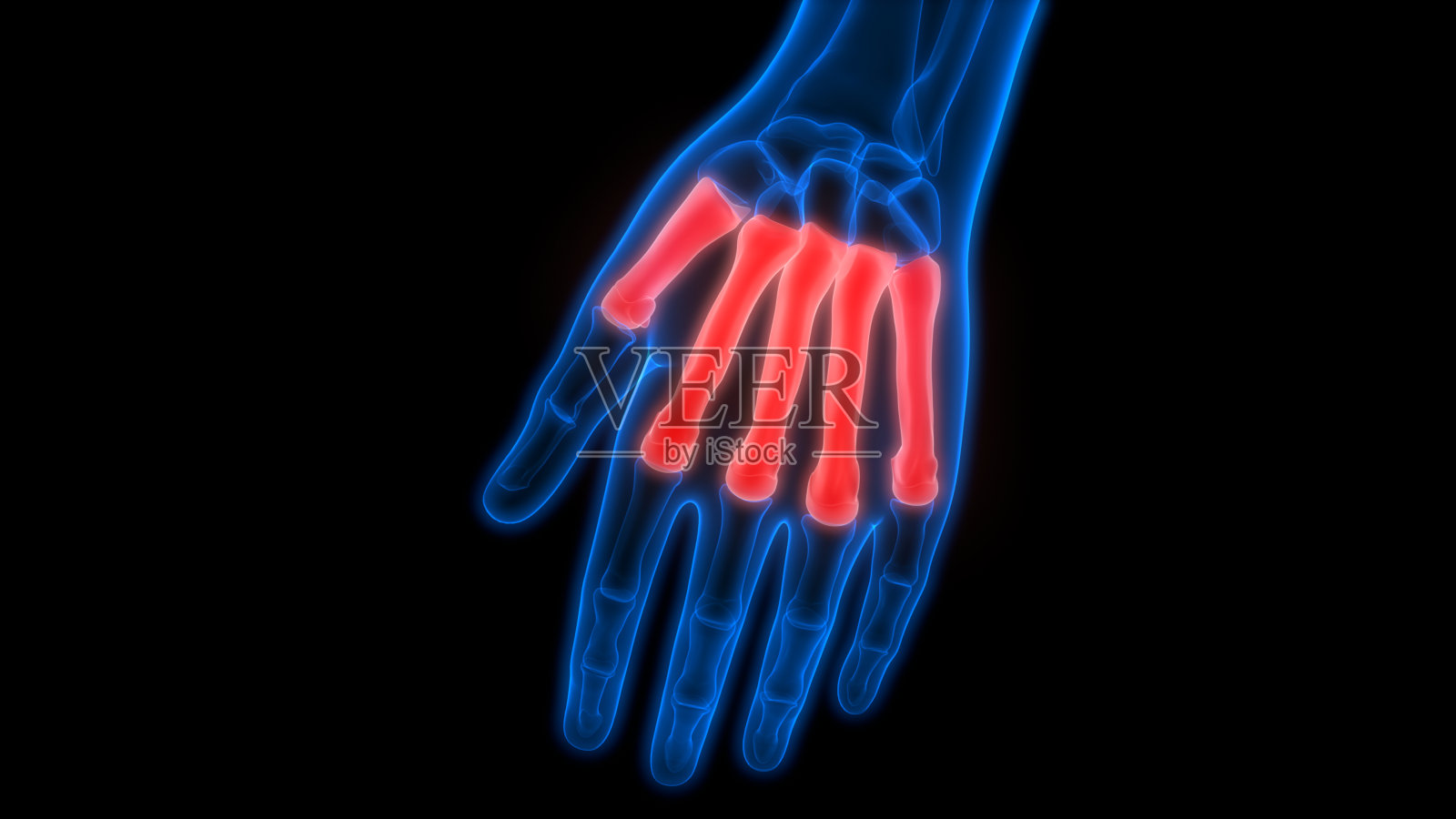 人类骨骼系统掌骨关节解剖学照片摄影图片