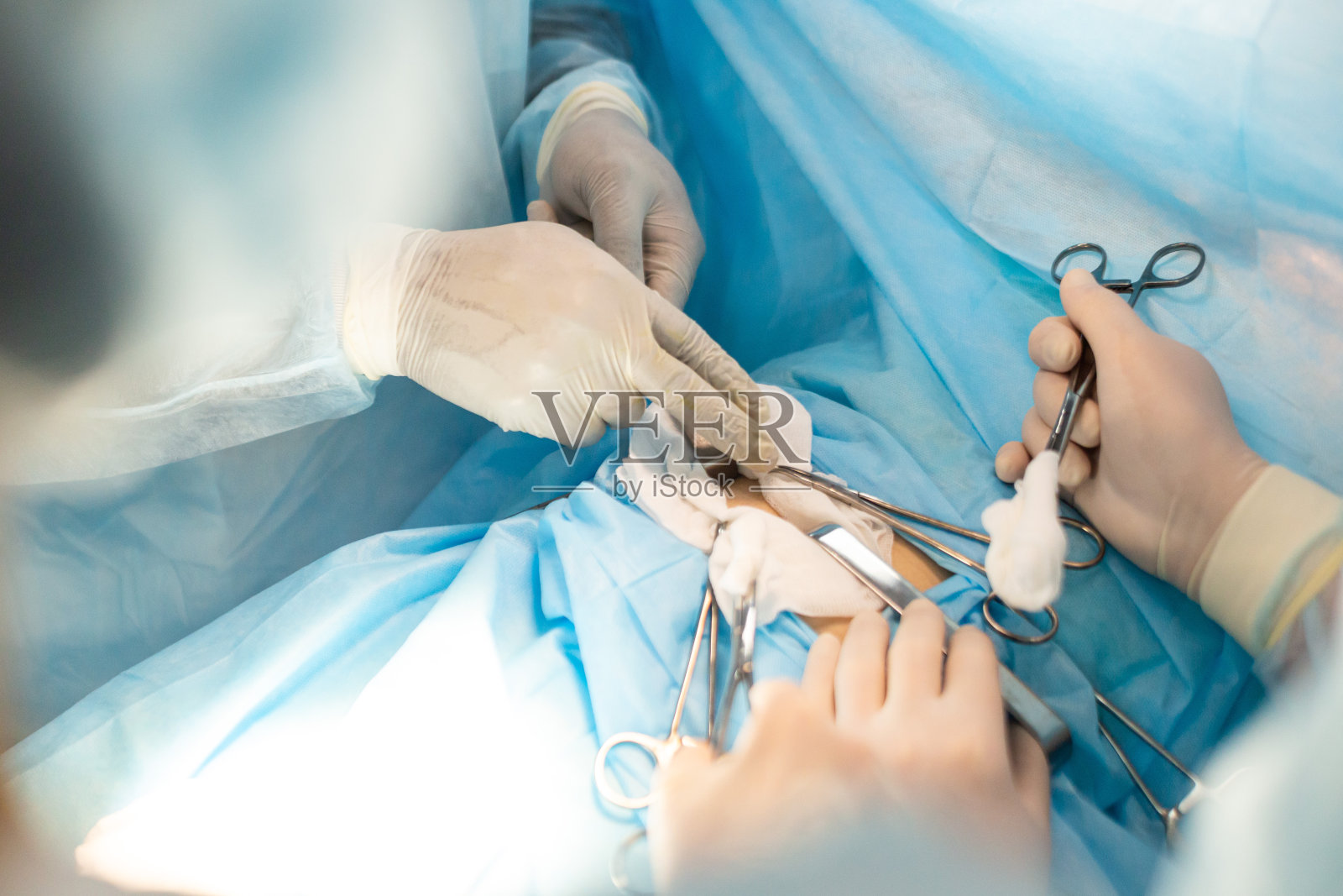 特写医生的手在医疗手套手术期间照片摄影图片