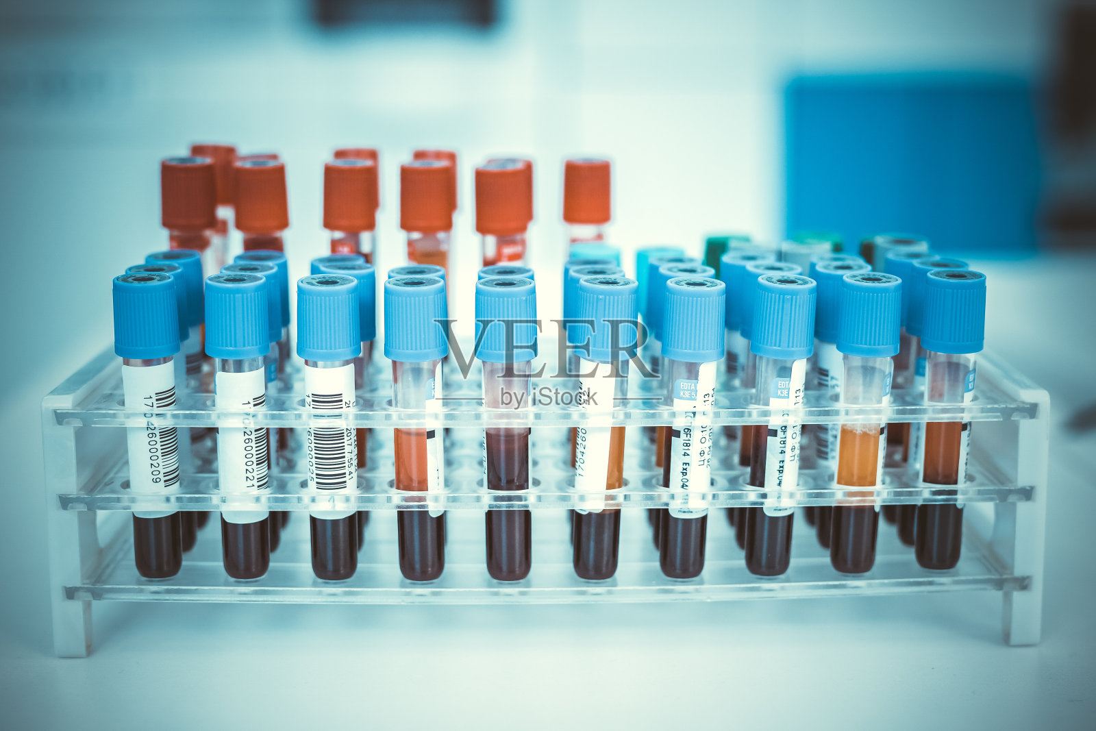 冠状病毒血液检测的概念。用于冠状病毒检测的试管血液样本分析。2019-nCoV或COVID-19检测用血管。照片摄影图片