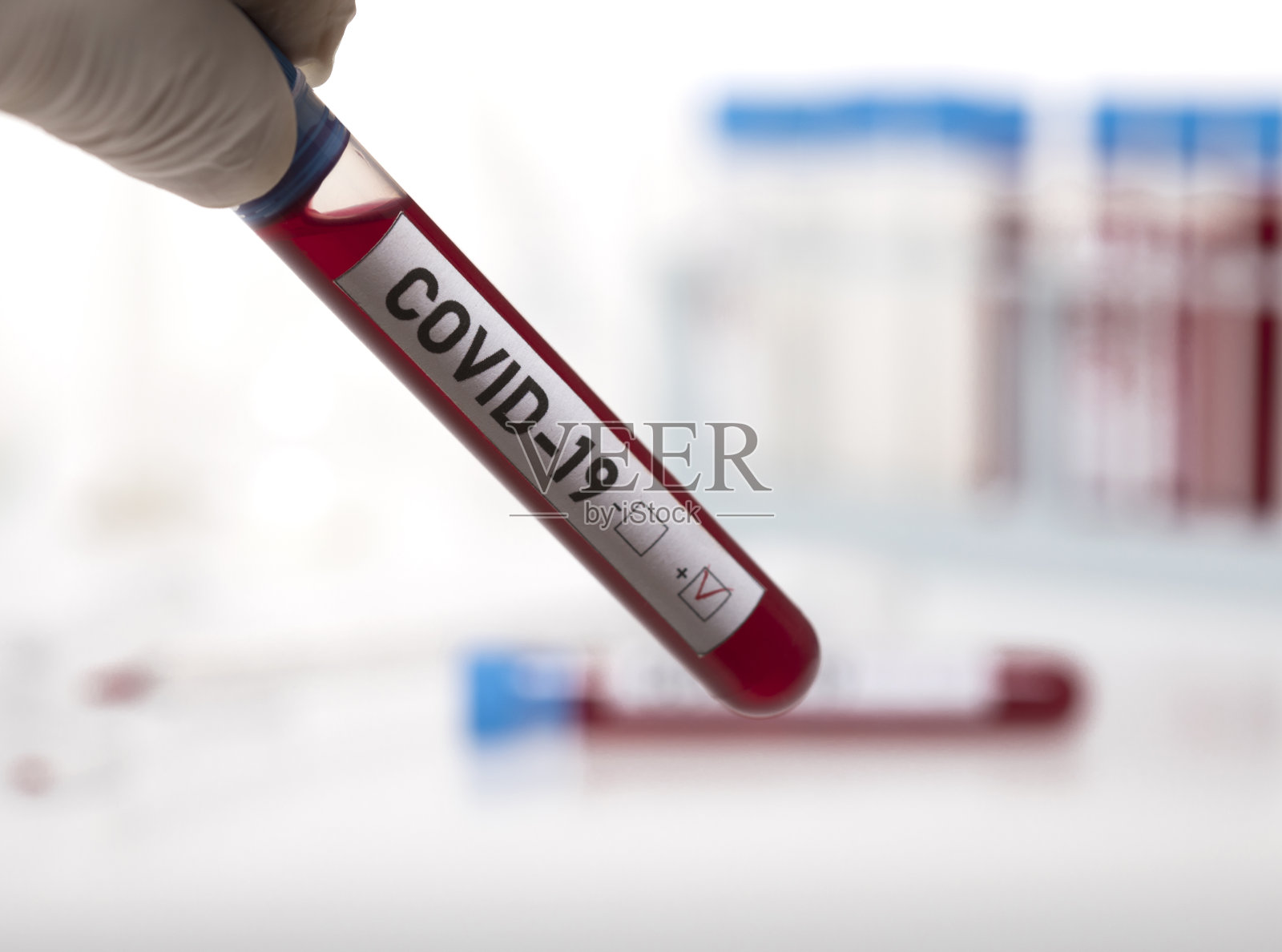 微生物学家，带一管标记为Covid-19的被冠状病毒污染的生物样本照片摄影图片