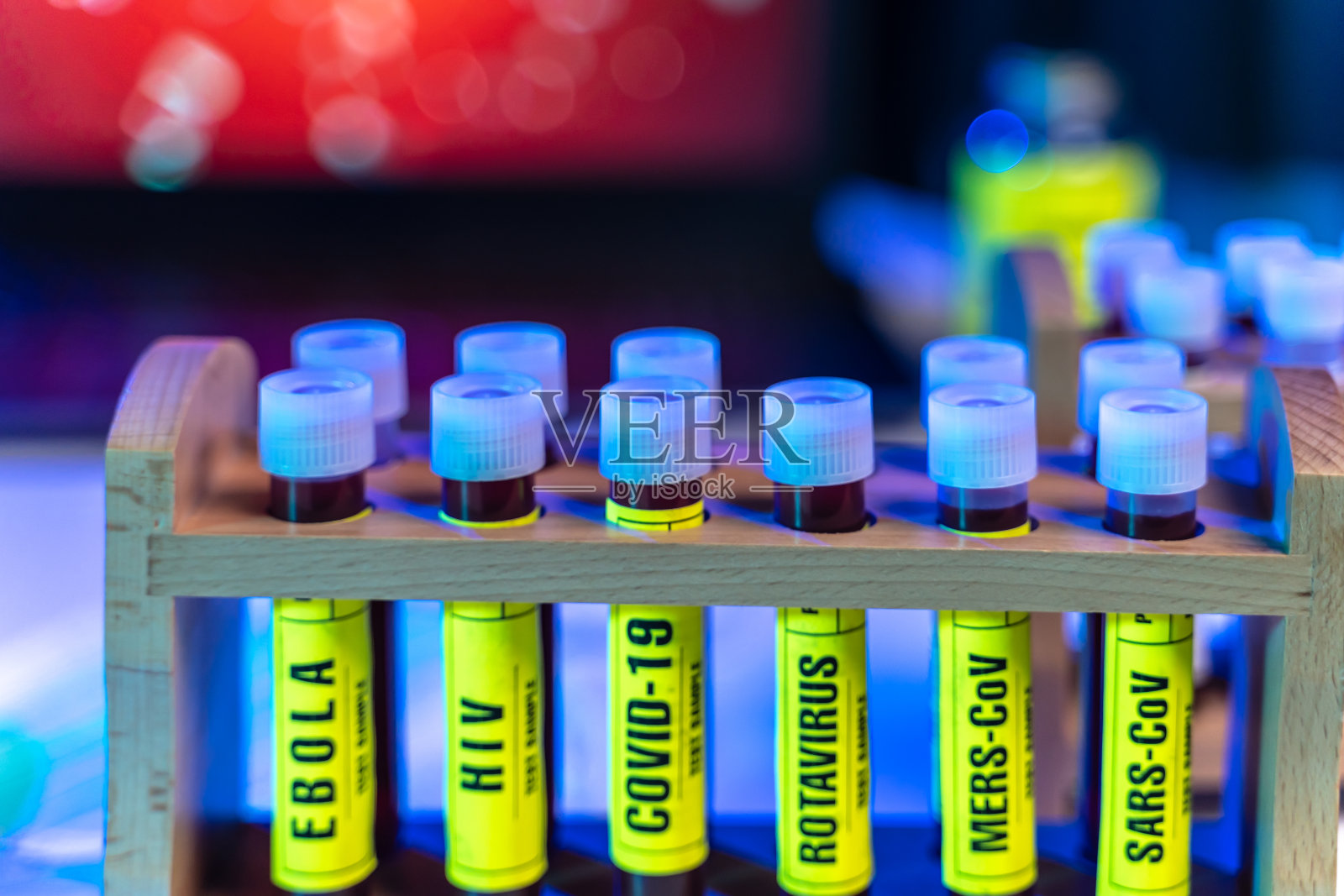 埃博拉、艾滋病毒(艾滋病)、COVID-19(冠状病毒)、轮状病毒、MERS-CoV和SARS-CoV血液检测试管照片摄影图片