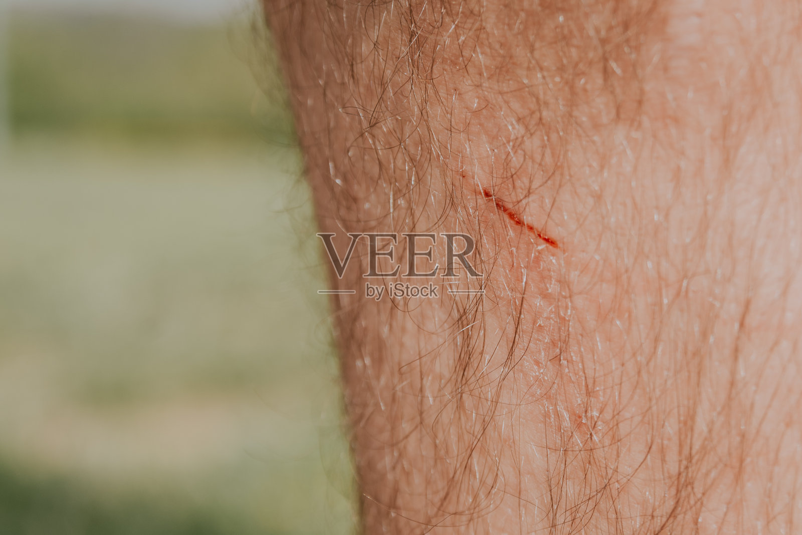 身体上有血伤照片摄影图片