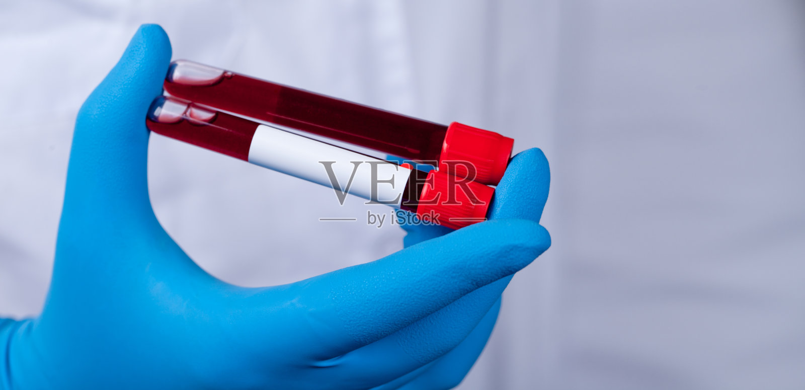 冠状病毒2019-nCoV血液样本。照片摄影图片