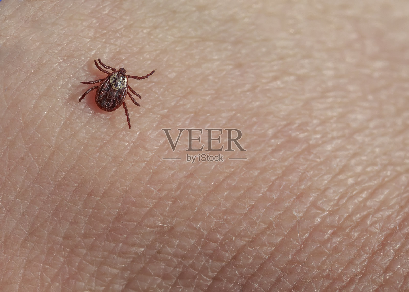 褐色小虫螨在人体皮肤上爬行，有感染各种传染病的危险照片摄影图片
