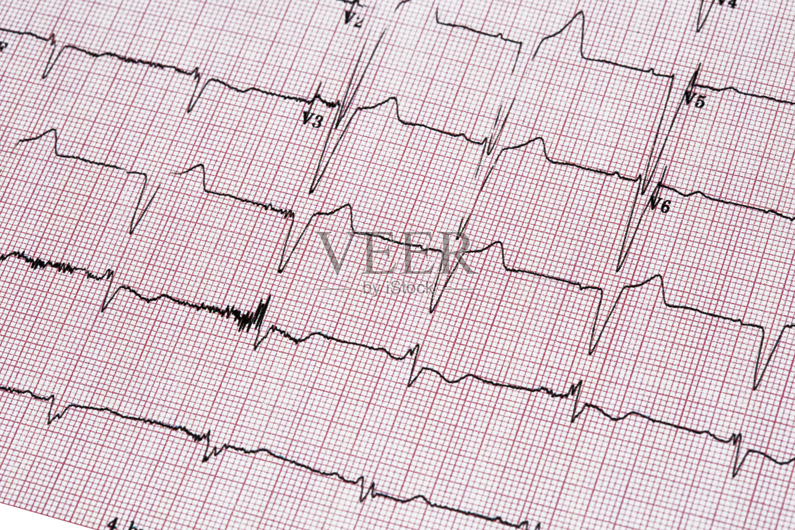 超声心动图特写报告照片摄影图片