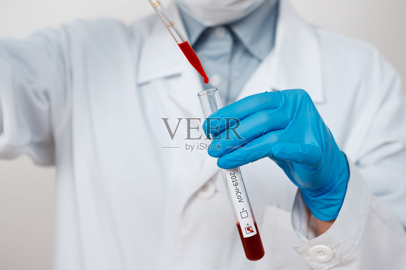 冠状病毒Covid - 19感染的血液样本在医生手中的采样管中照片摄影图片