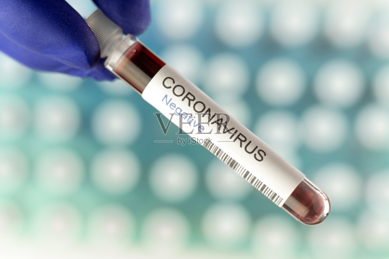 实验室冠状病毒检测阴性。照片摄影图片