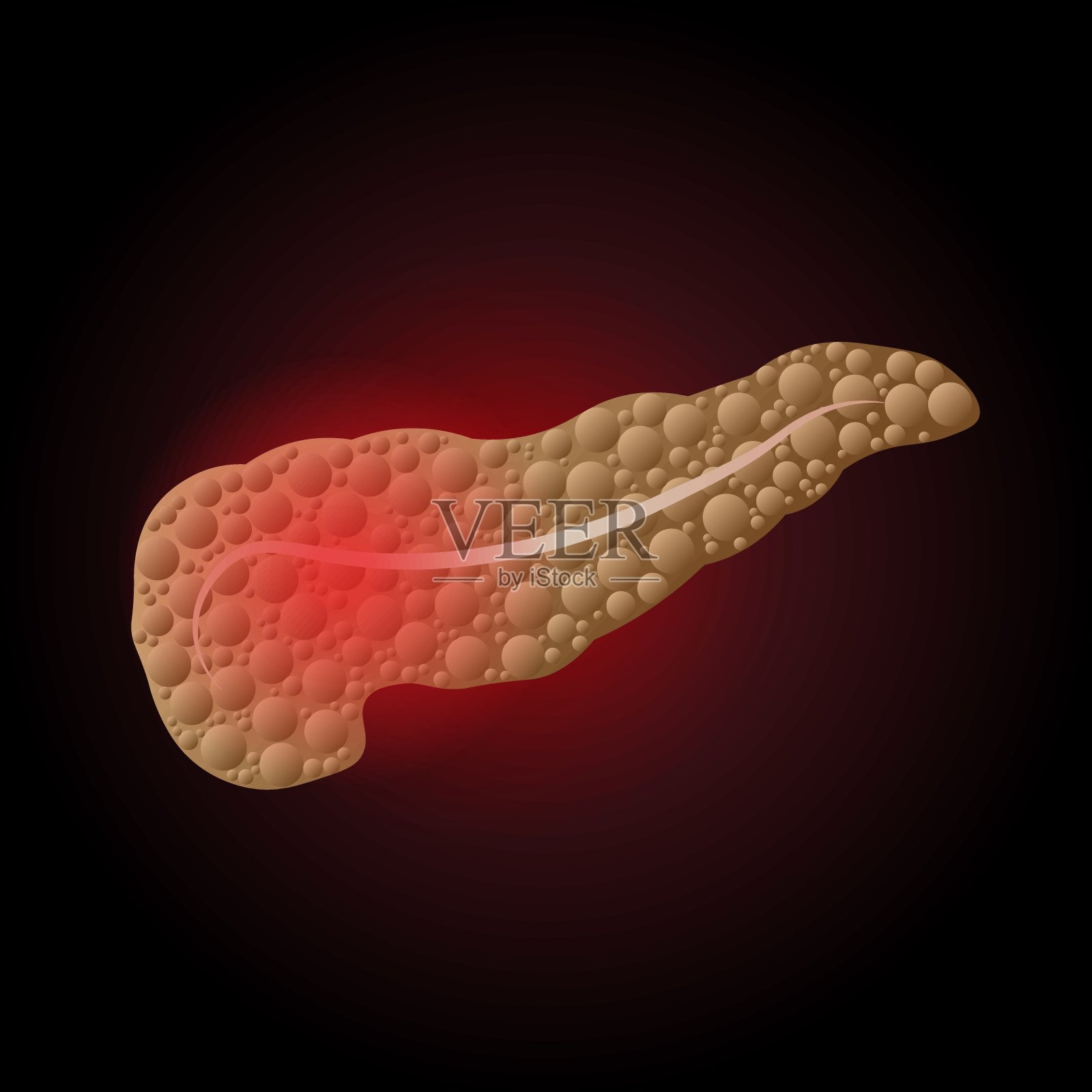 胰脏疾病的医学说明与疼痛点，胰腺炎插画图片素材