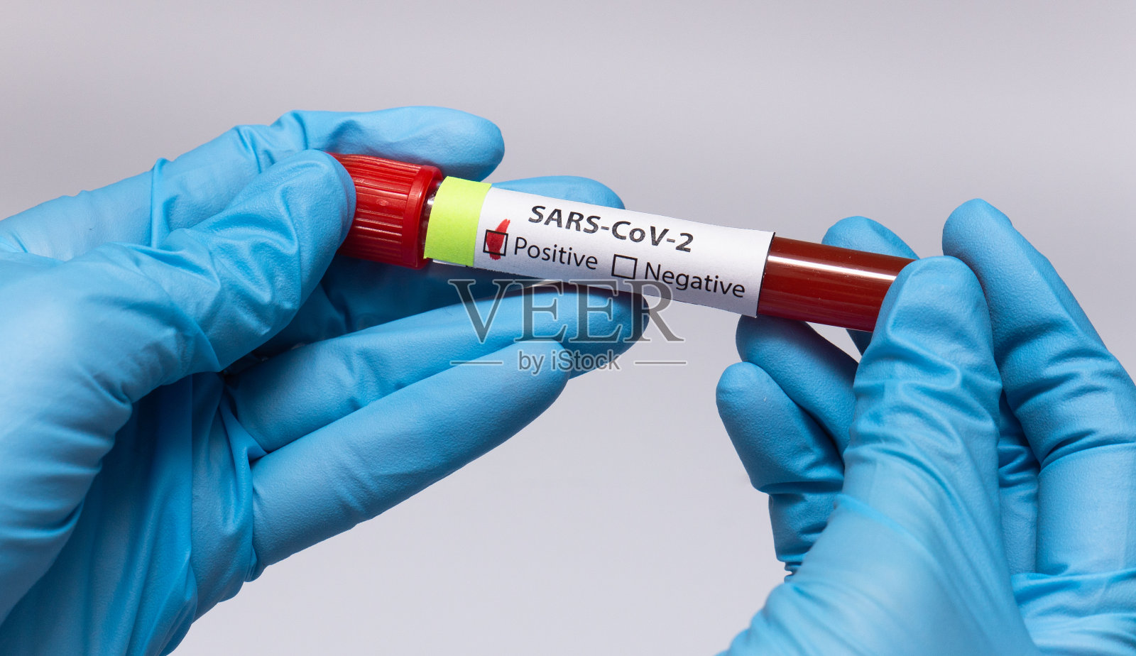 冠状病毒血液检测阳性。医学研究，带血的试管，手拿医用乳胶手套。冠状病毒爆发和流感。2019 - ncov covid-19,非典。高质量的照片。照片摄影图片