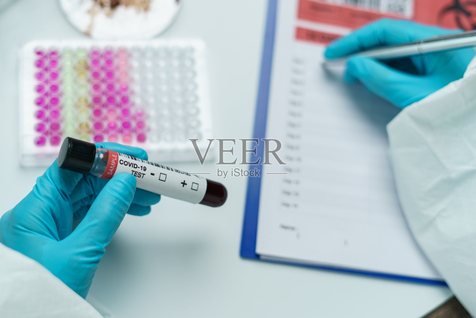 科学家手拿血样管，撰写血液检测报告。冠状病毒测试过程。照片摄影图片