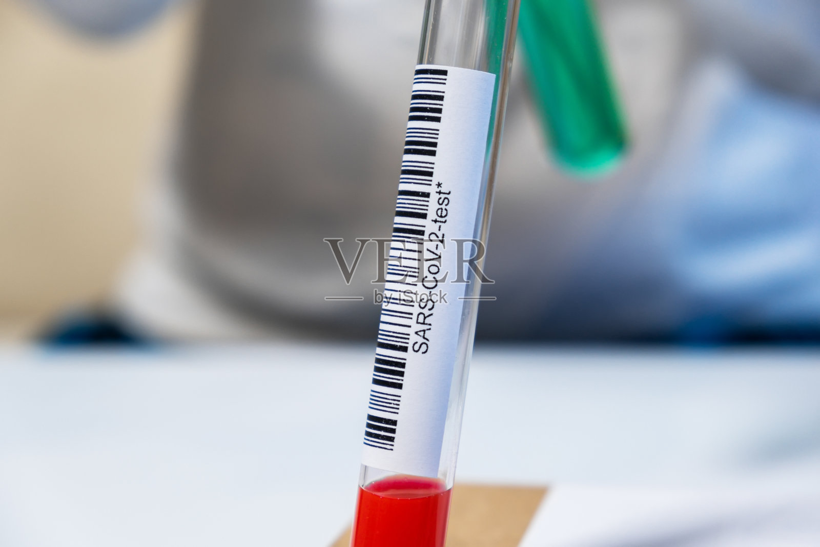 手里拿着SARS-CoV-2试管，冠状病毒COVID-19照片摄影图片