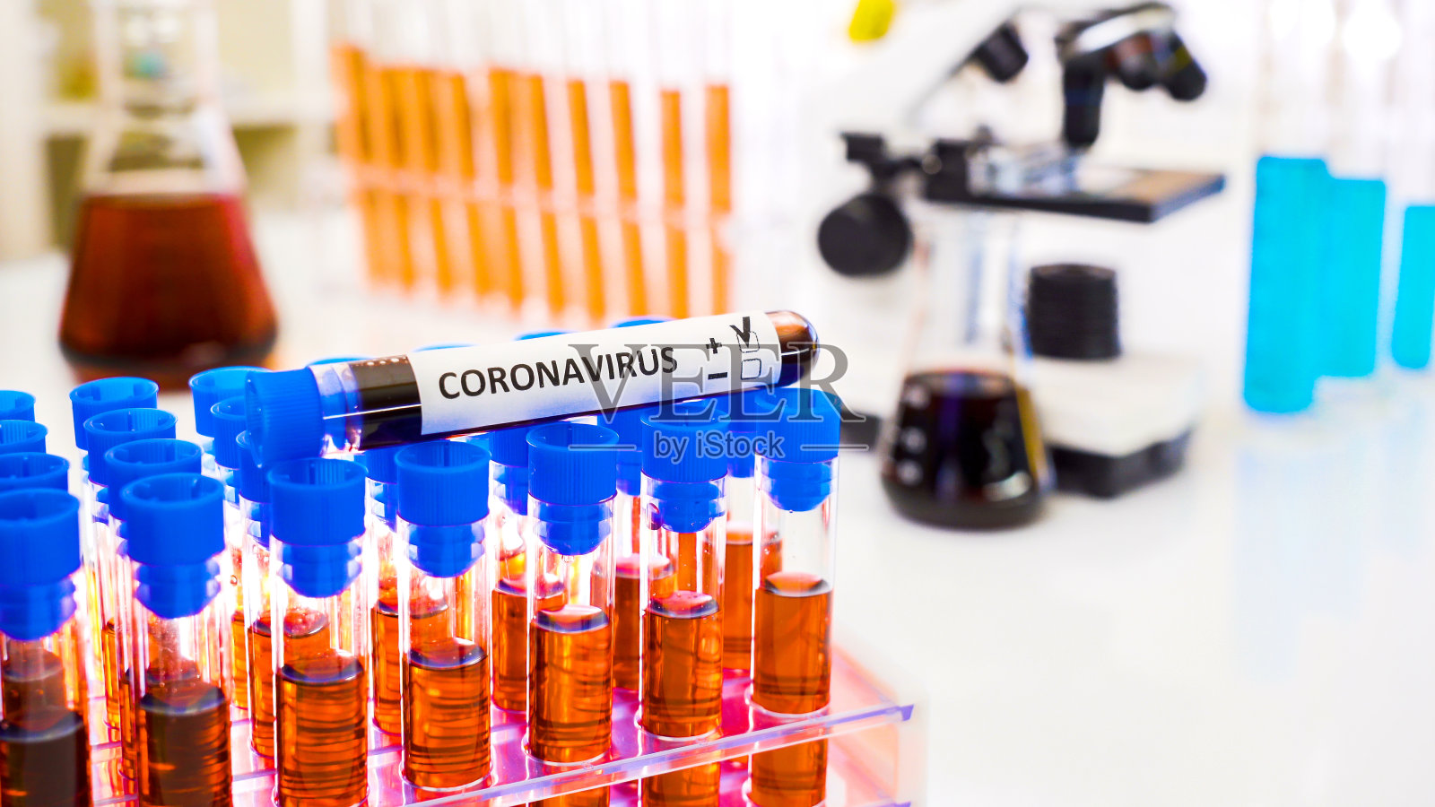 冠状病毒采集管位于管架顶部照片摄影图片