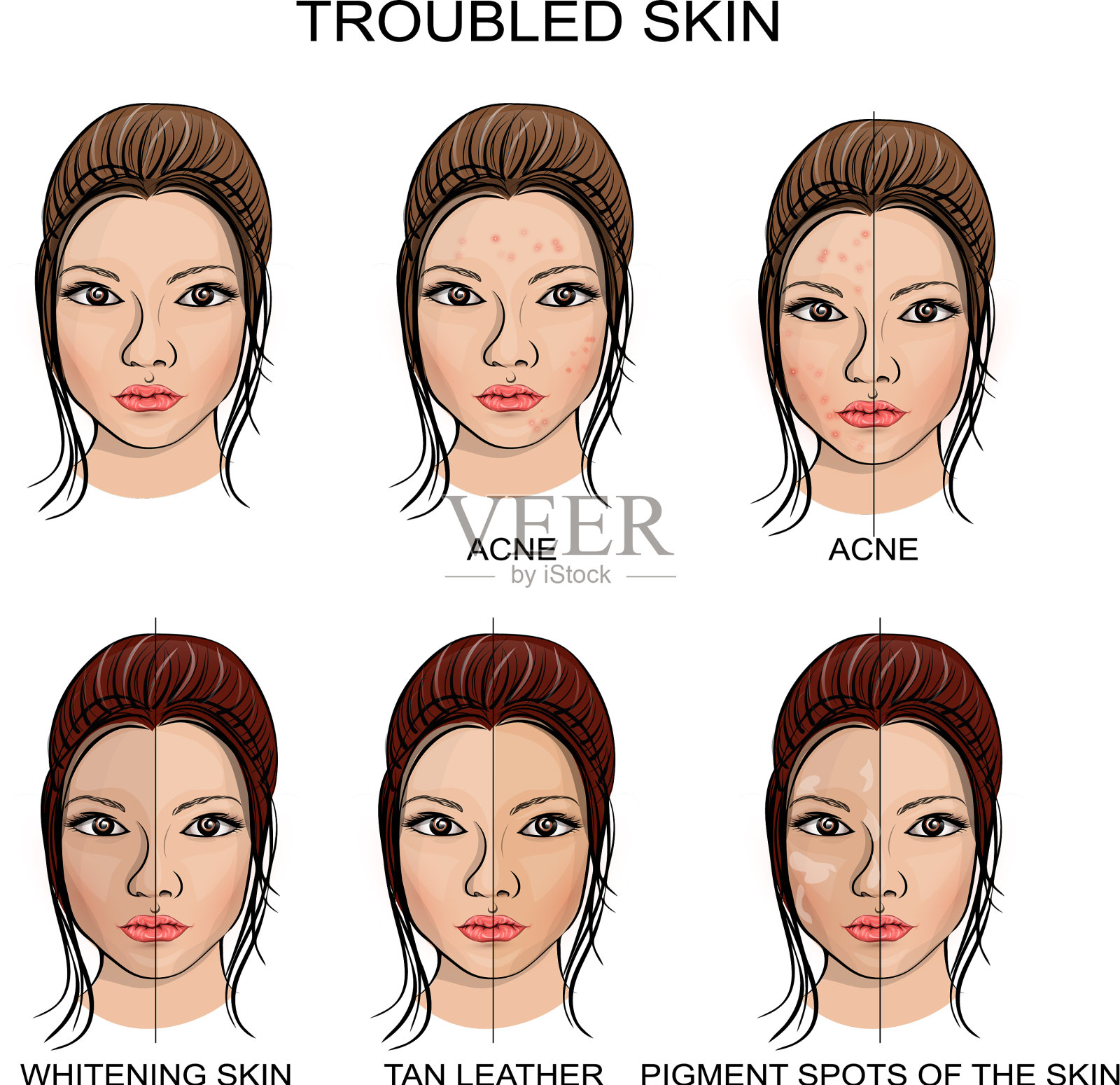 问题皮肤和健康皮肤插画图片素材