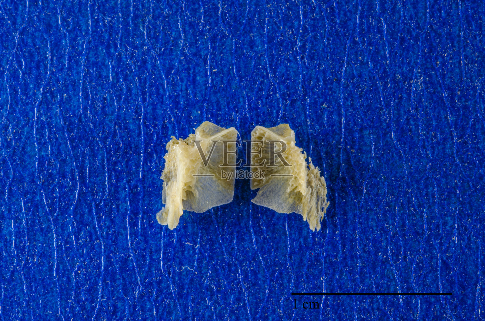 腭骨，人类胎儿十周大。照片摄影图片