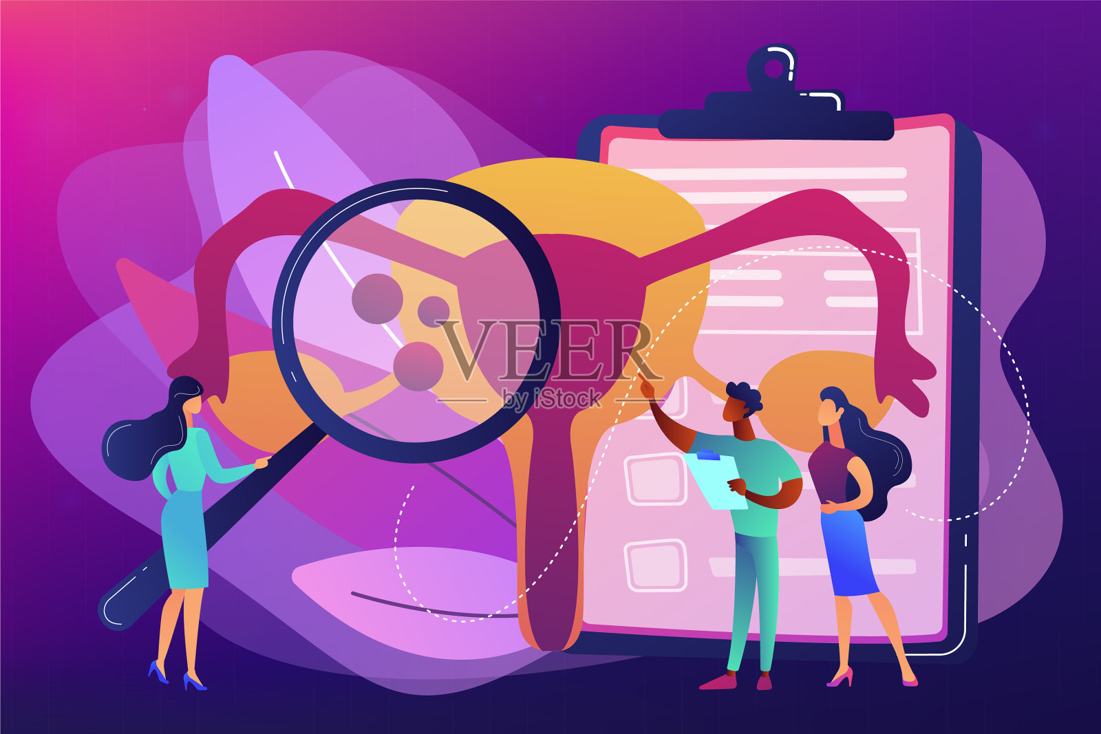 子宫内膜异位的概念插画图片素材