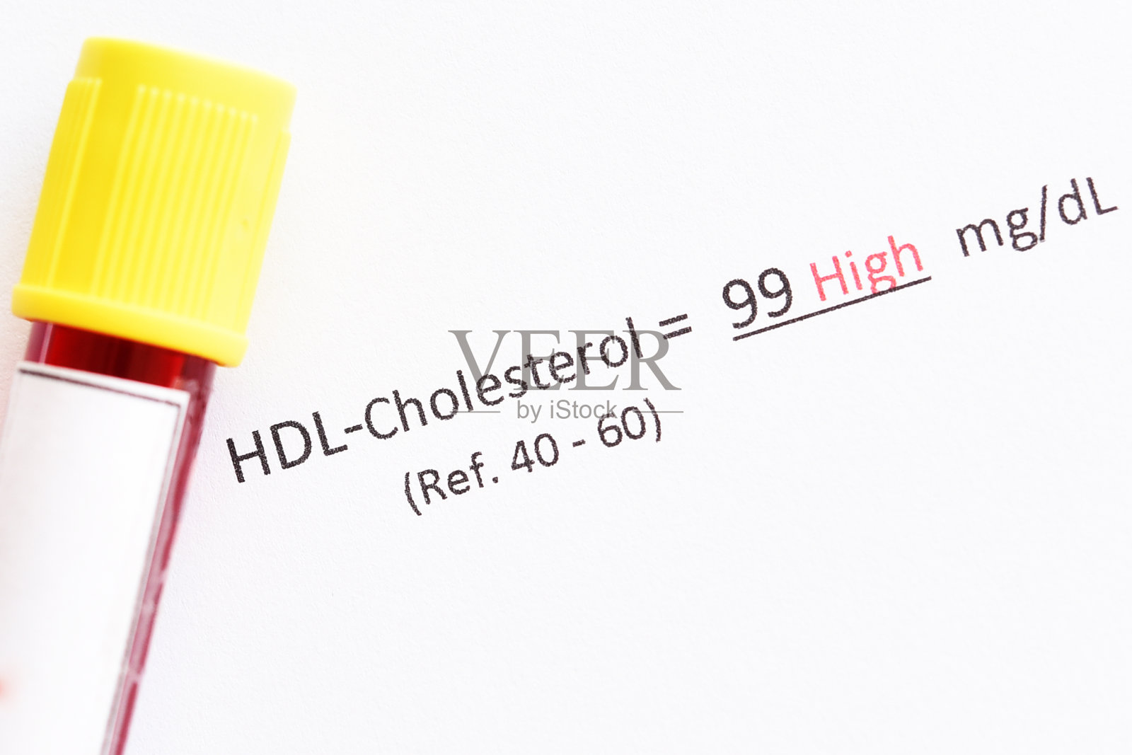 高密度脂蛋白胆固醇（HDL）测试结果照片摄影图片