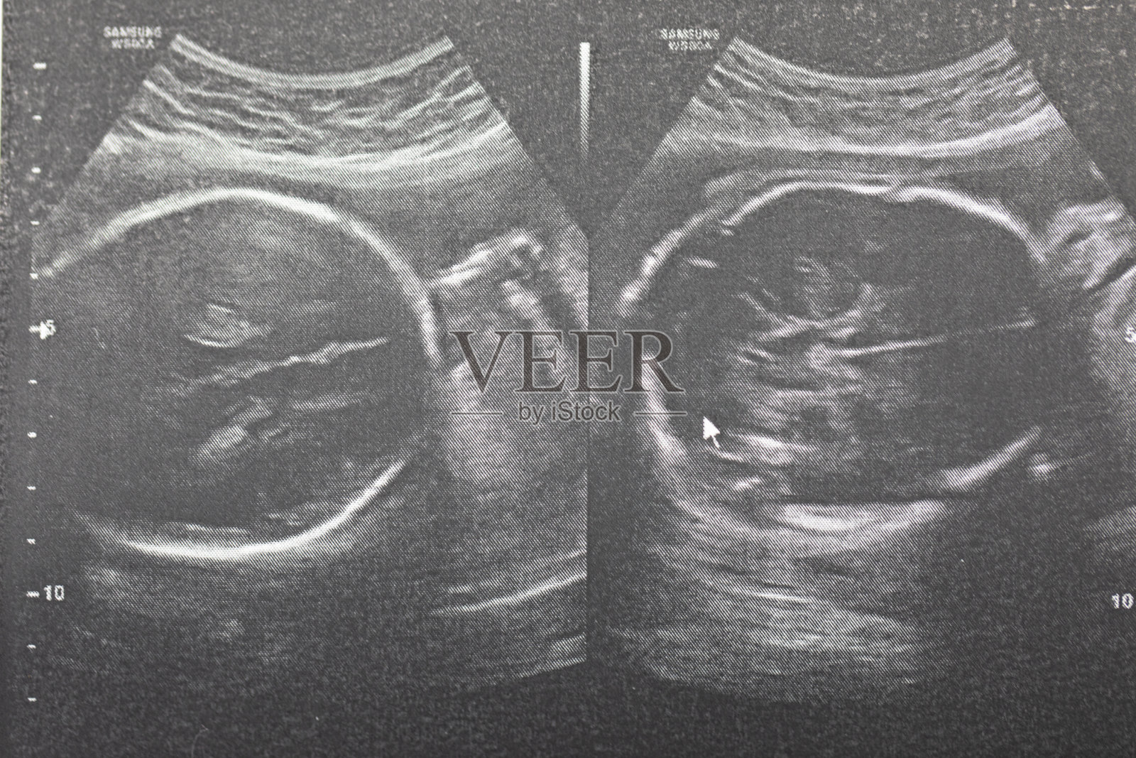 孕妇胎儿超声检查，医生通过超声读取孕妇检测结果。照片摄影图片