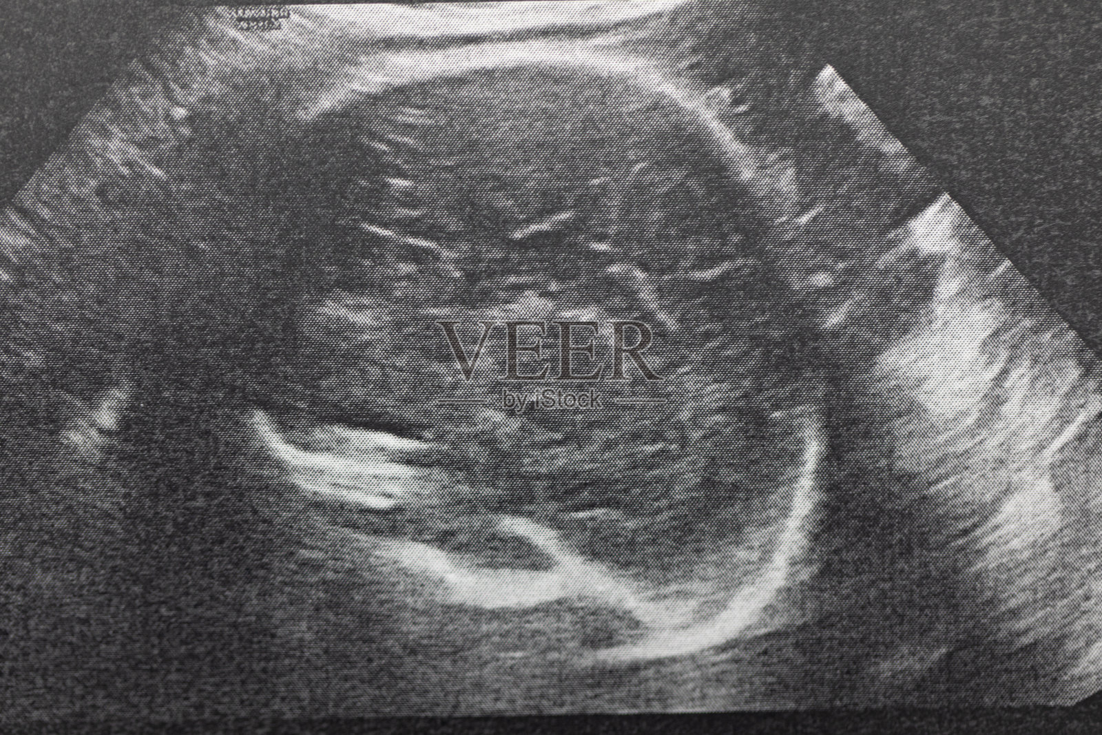 孕妇胎儿超声检查，医生通过超声读取孕妇检测结果。照片摄影图片