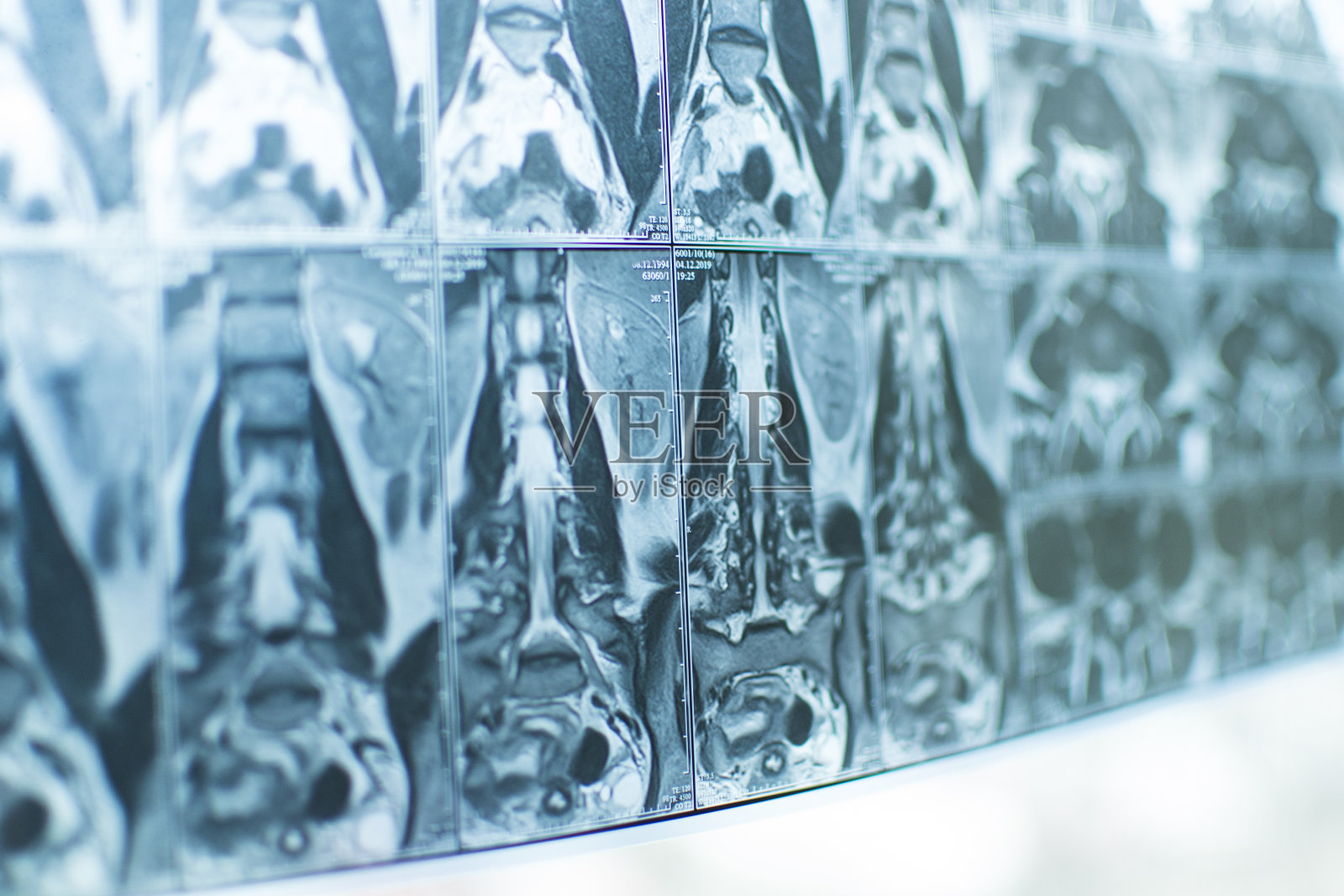 脊柱MRI。回腔的x光片。医疗业务、药品。身体的疾病。从不同的角度做了很多核磁共振。照片摄影图片