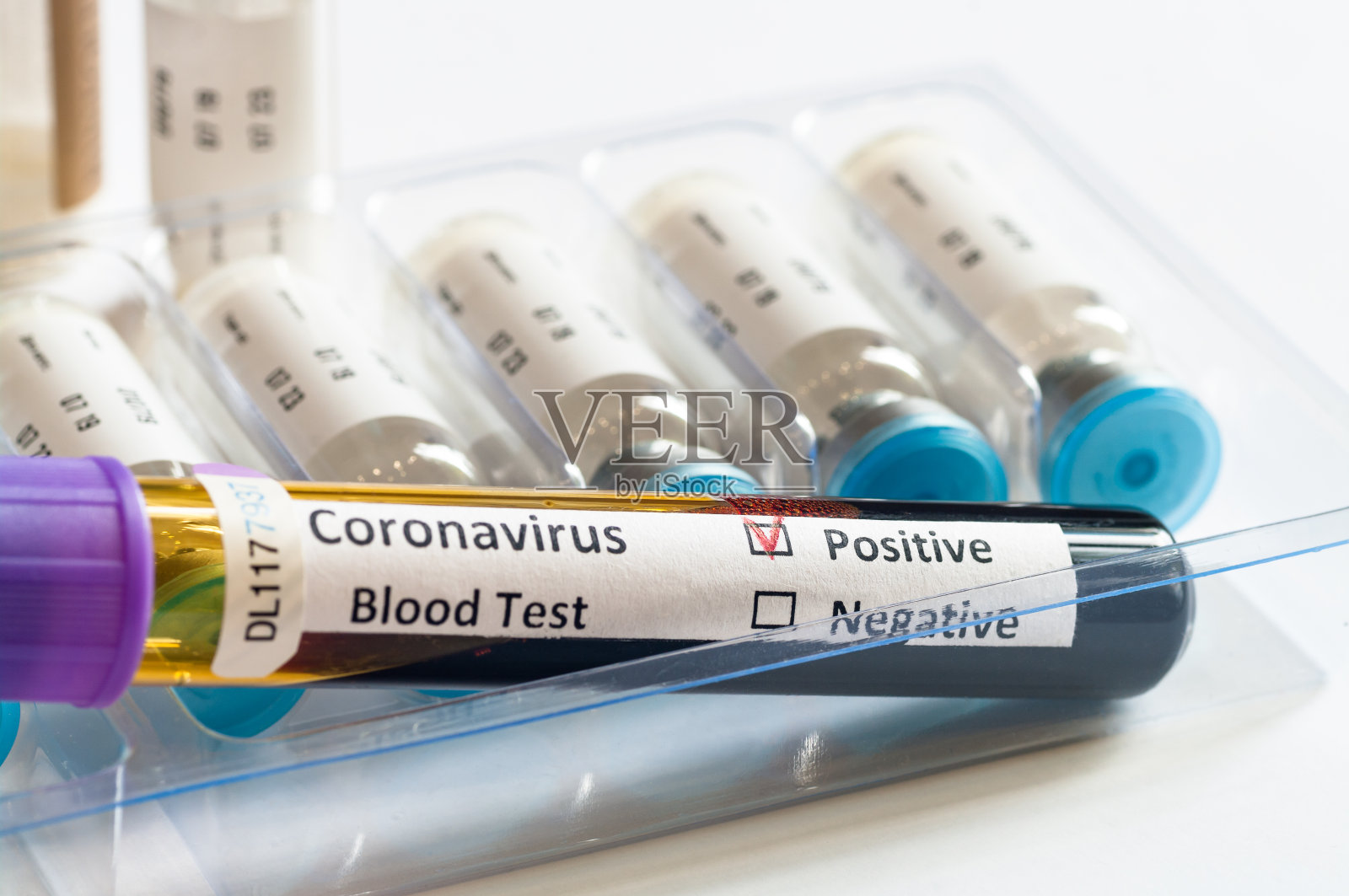 COVID-19或新型冠状病毒SARS-CoV-2血样管阳性照片摄影图片