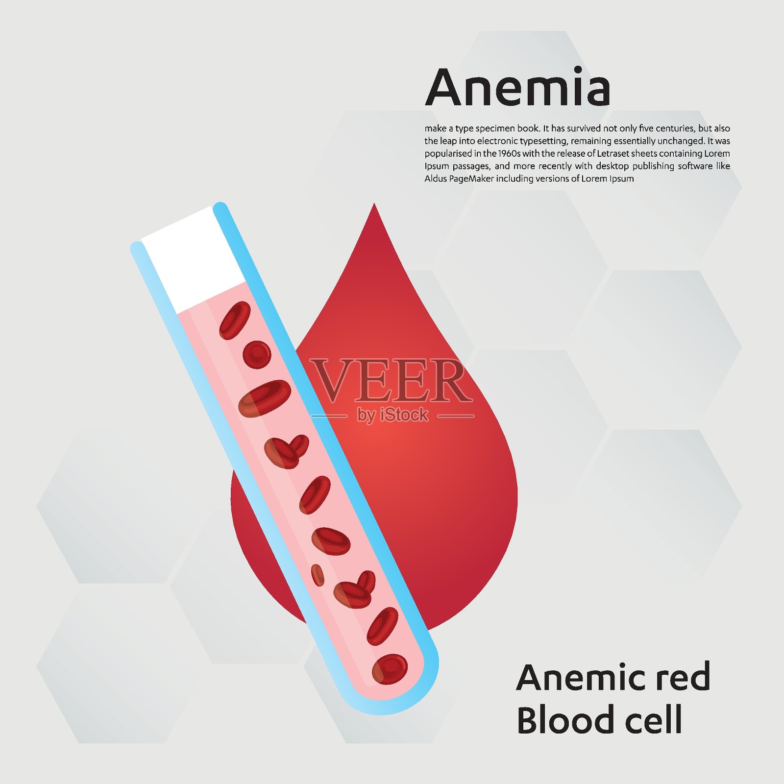 世界血友病日红细胞缺铁性贫血贫血量与正常症状病媒说明。插画图片素材