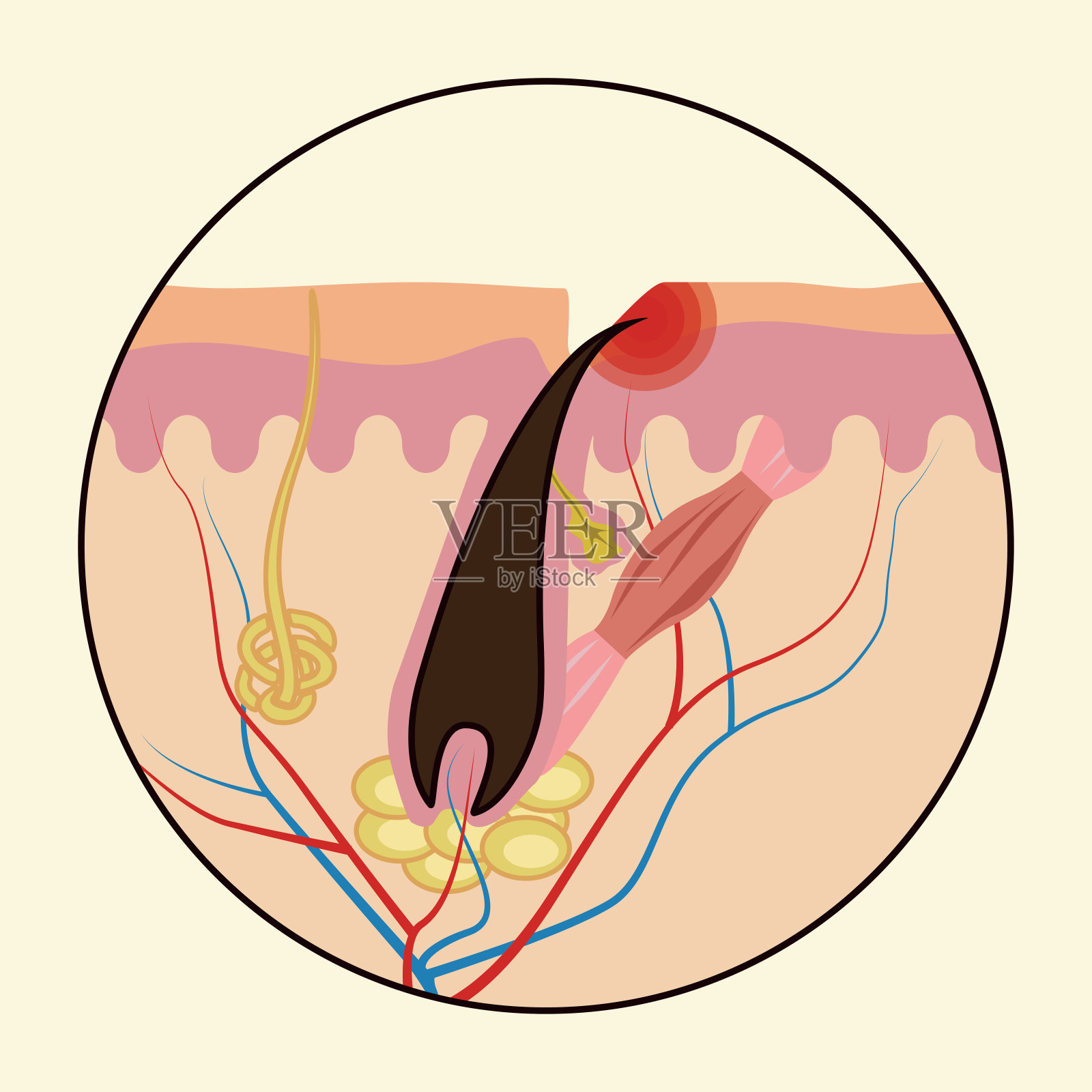 向内生长的毛。头发再生的医疗方案。矢量插图孤立在白色背景上设计和网页。插画图片素材