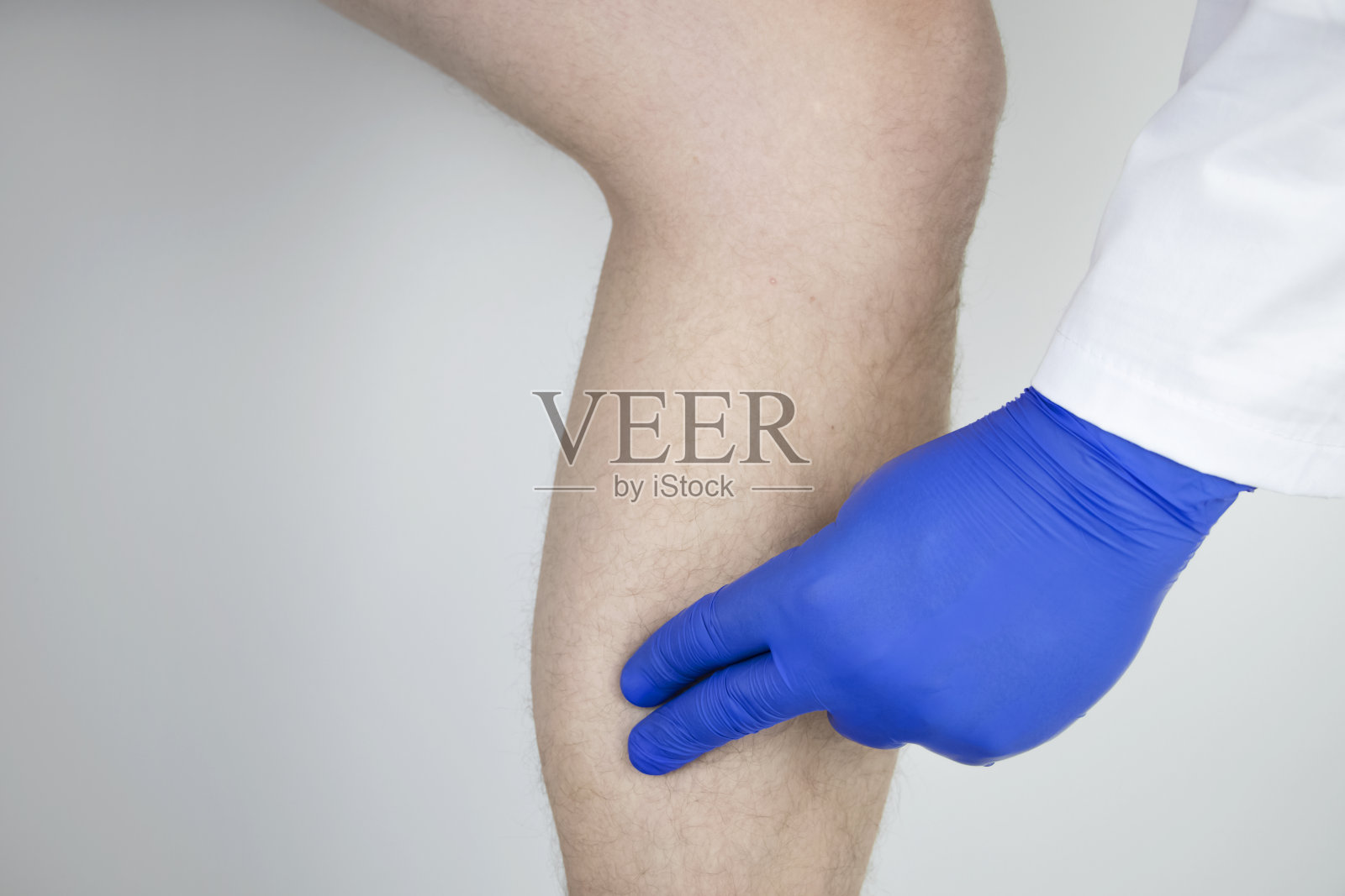 一个男人的小腿疼痛。拉伸小腿肌肉，静脉曲张，腿部抽筋或肌炎。骨科医生检查照片摄影图片