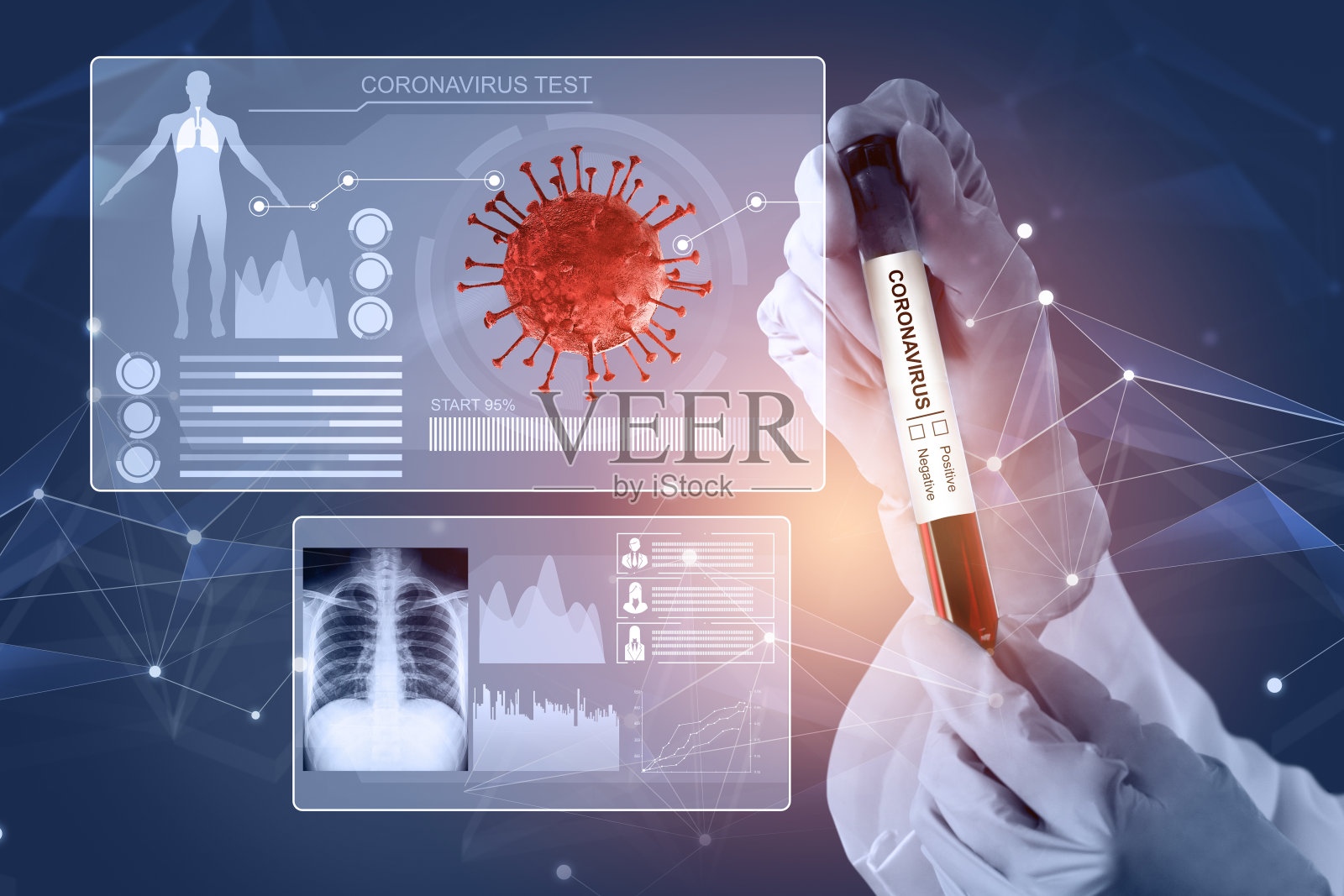 新型冠状病毒肺炎医学检测疫苗研发理念。照片摄影图片