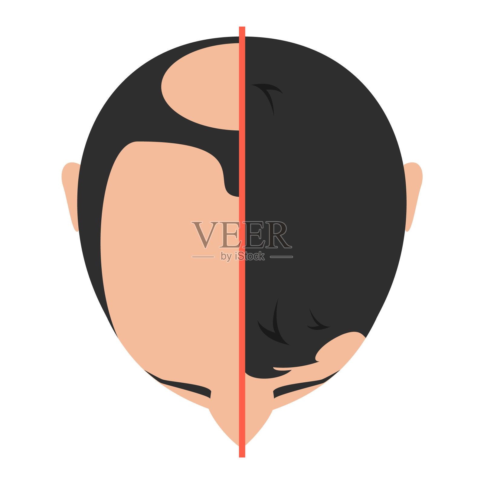 海特移植前后插画图片素材