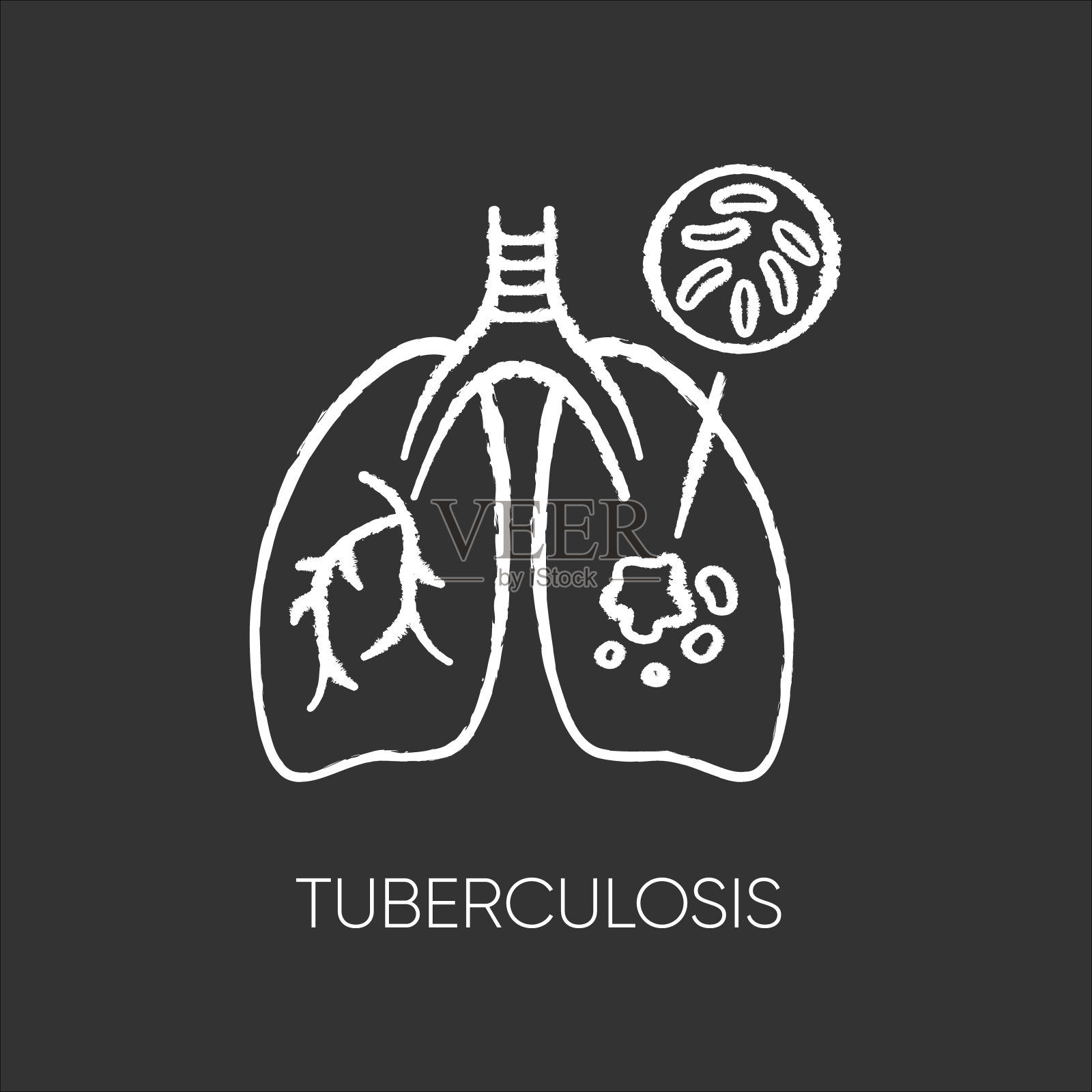 结核病粉笔白色图标在黑色背景。传染性呼吸道疾病，危险的传染性疾病，肺部疾病。肺与结核病毒分离载体黑板插图插画图片素材