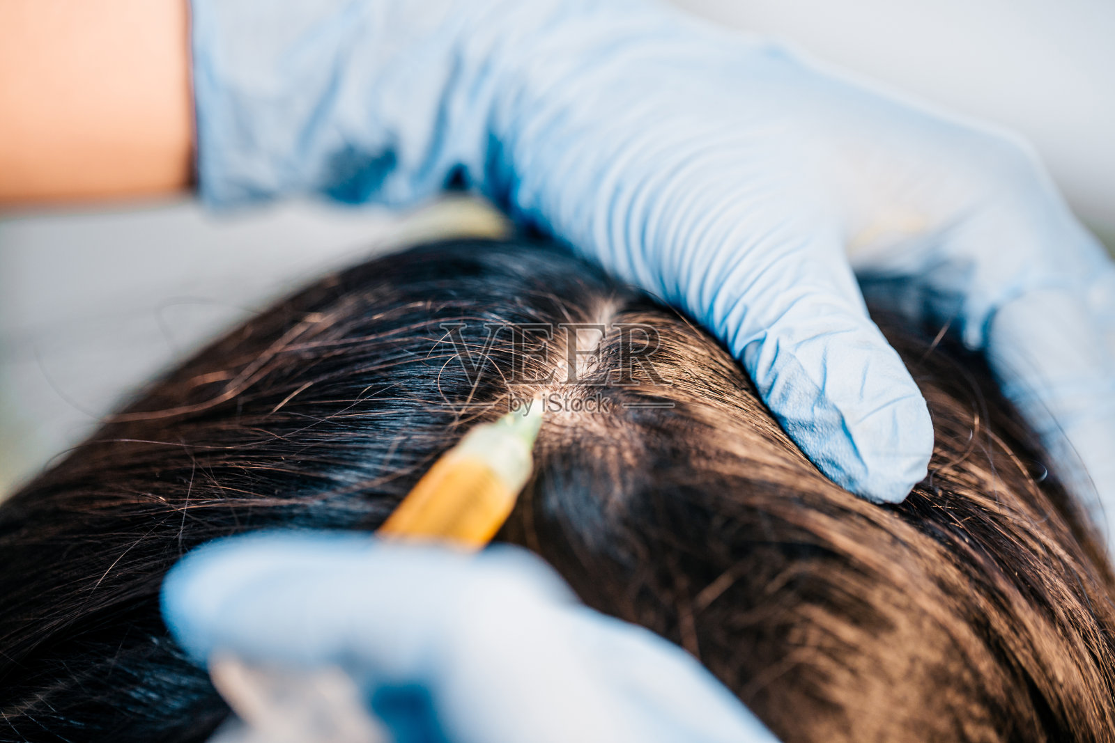 戴着橡胶手套的医生正在进行医疗程序照片摄影图片