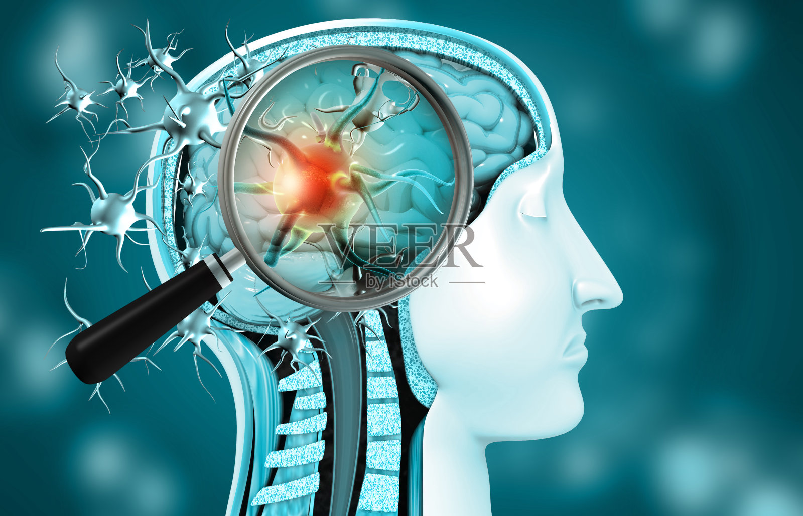 脑内病毒感染照片摄影图片