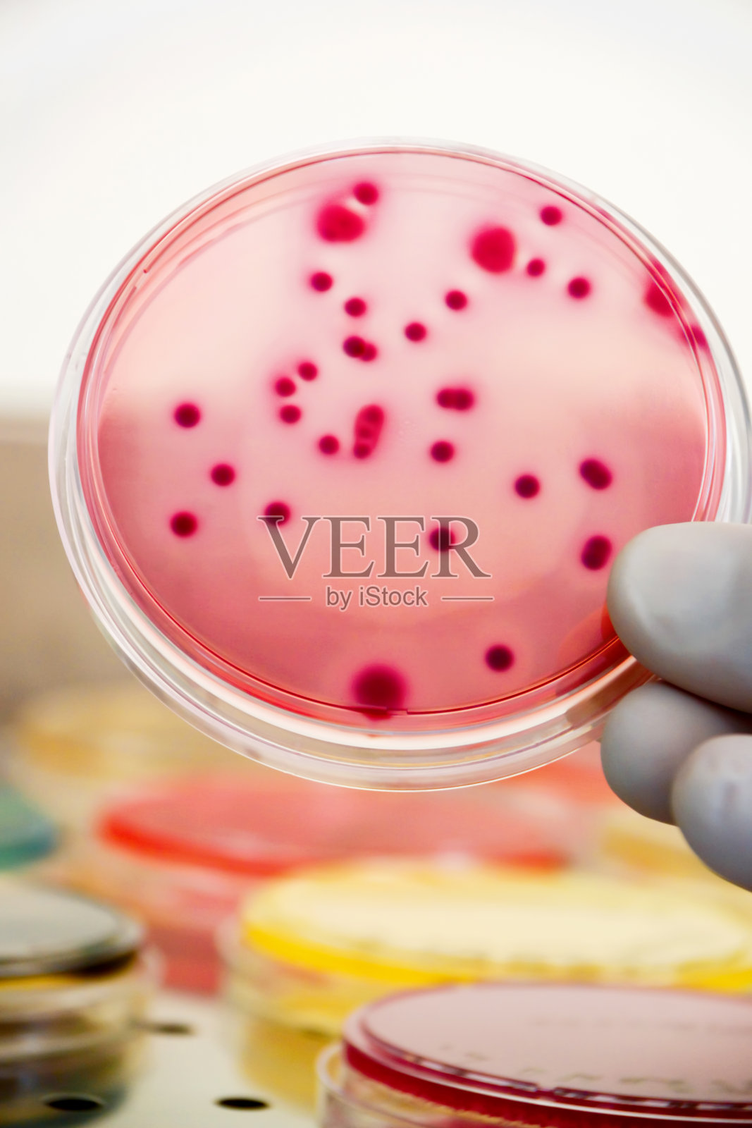 细菌菌落文化照片摄影图片