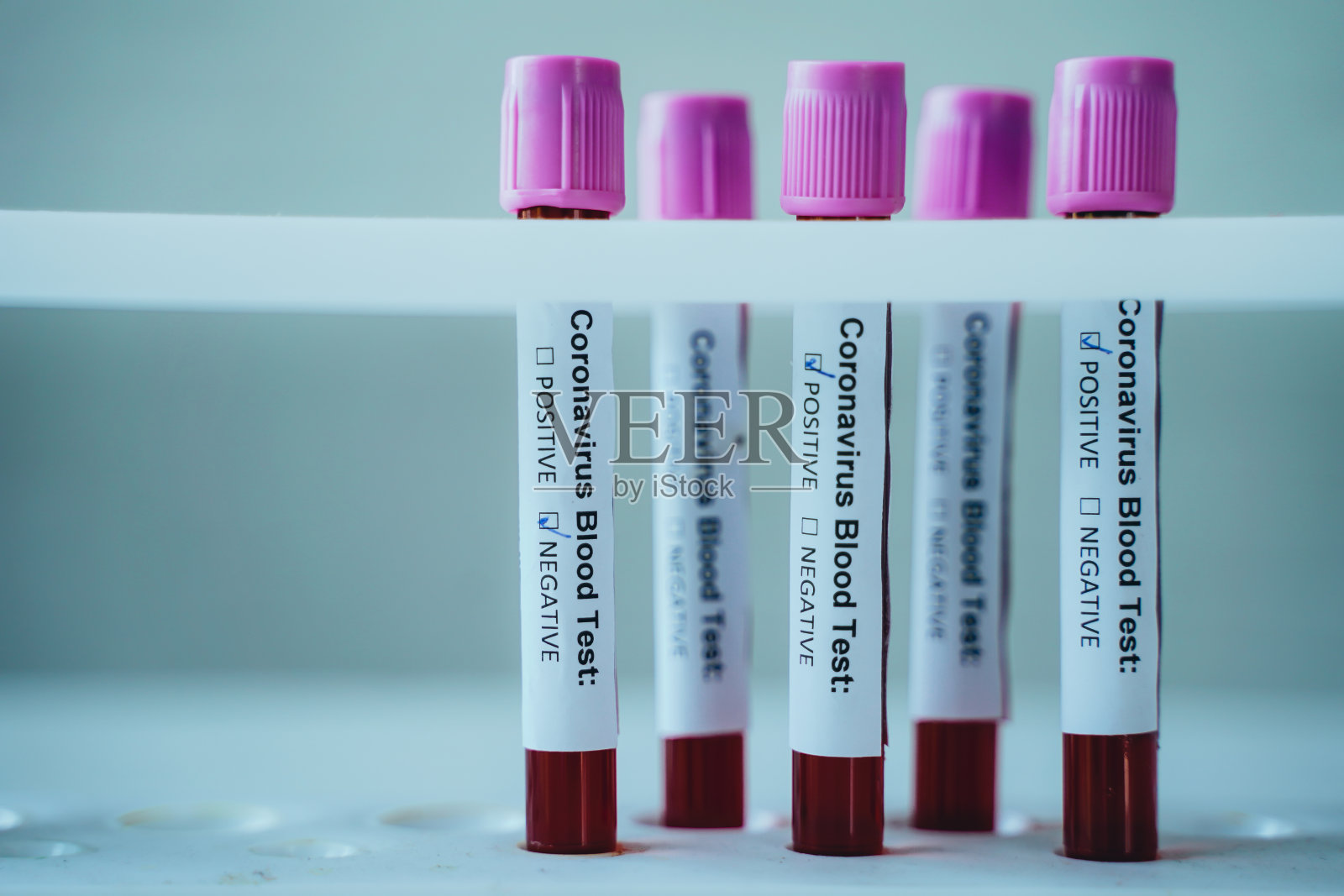 实验室冠状病毒(Covid-19)阳性试管照片摄影图片