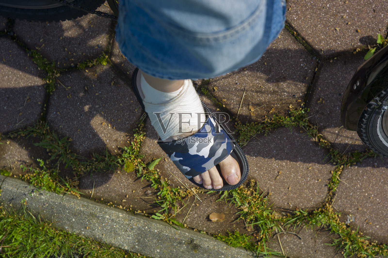 腿受伤骑自行车照片摄影图片