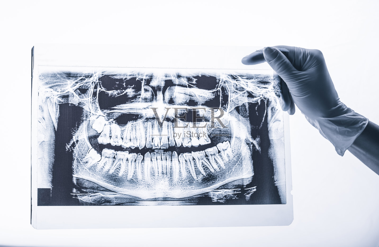 手捧口腔牙科x光隔离照片摄影图片