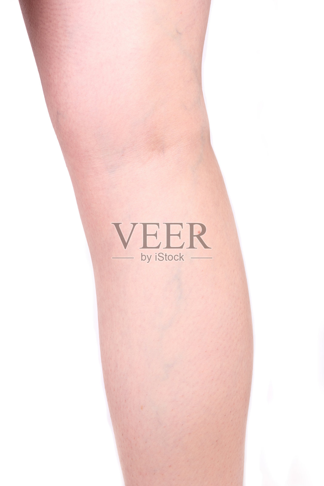 女性腿部背部的静脉曲张。照片摄影图片