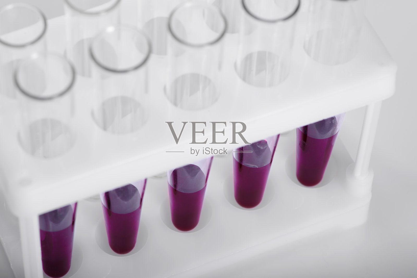 血液试管在医学实验室中的科学和研究照片摄影图片