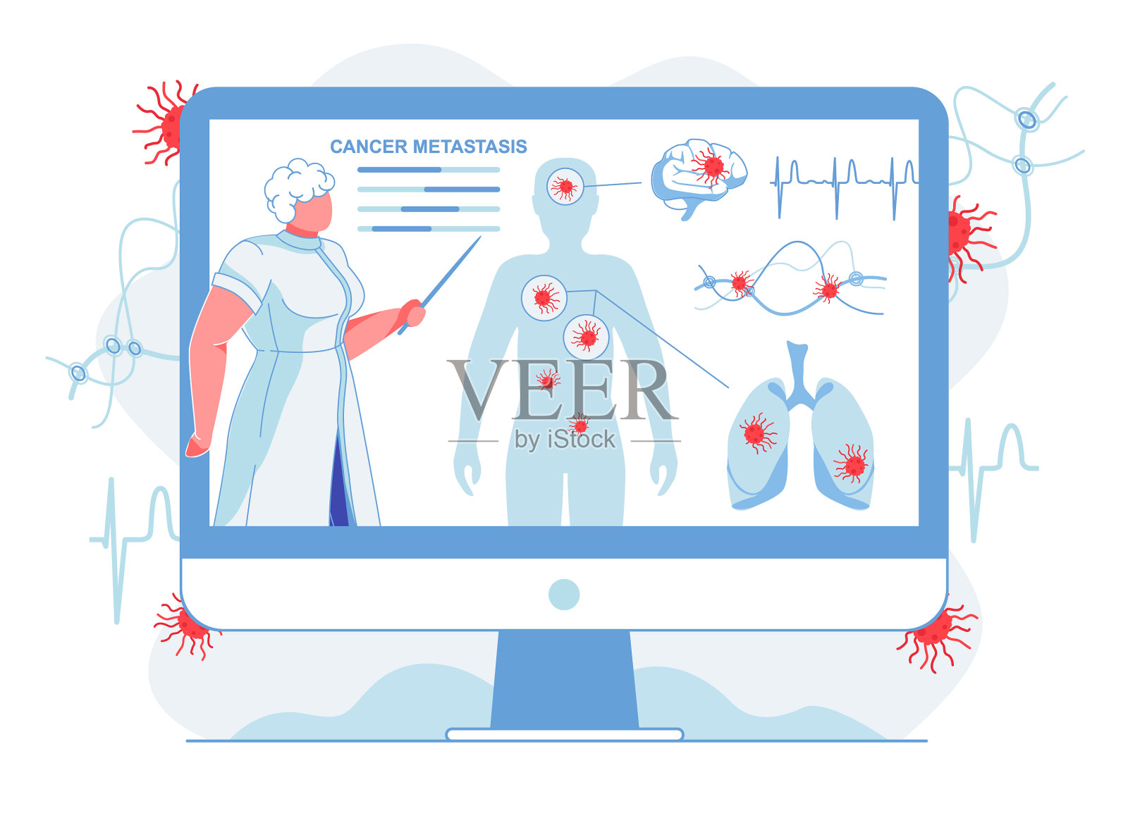 医生显示癌症转移平稳插画图片素材