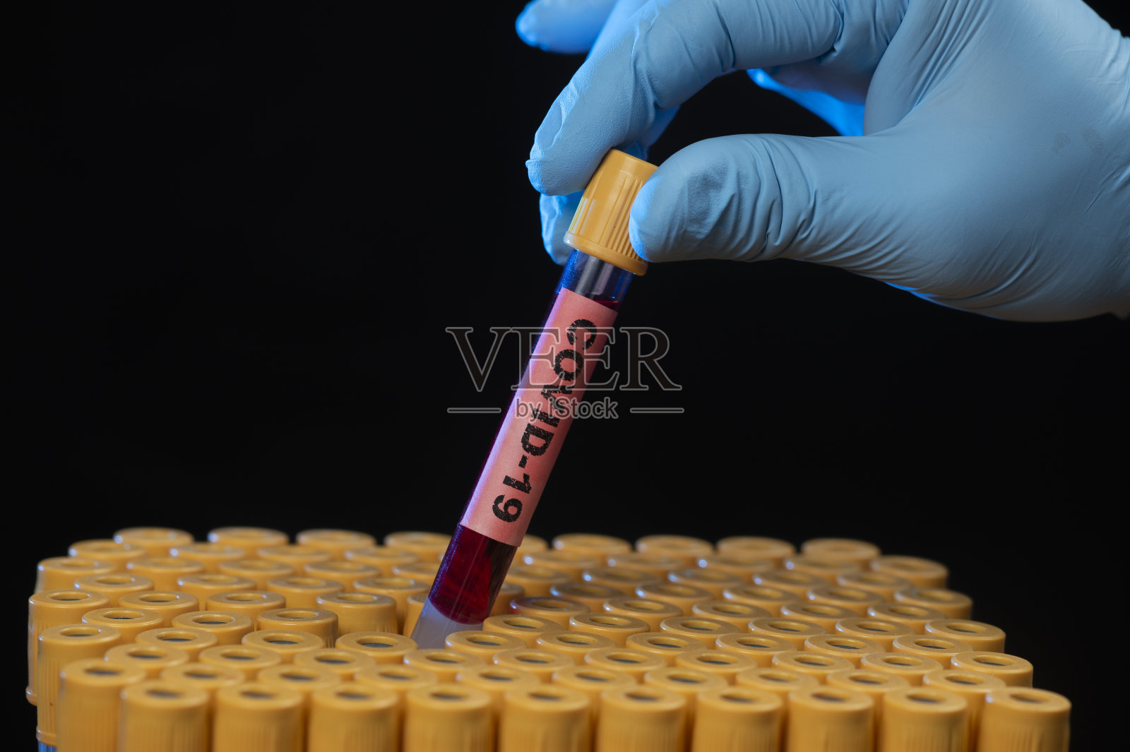 卫生专业人员手持血液样本管照片摄影图片