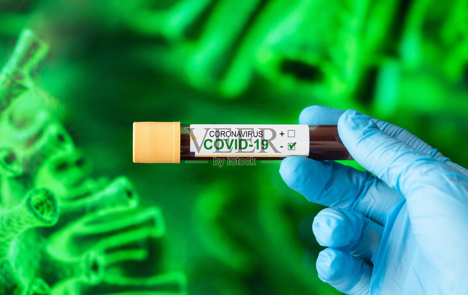 COVID-19血样管阴性照片摄影图片