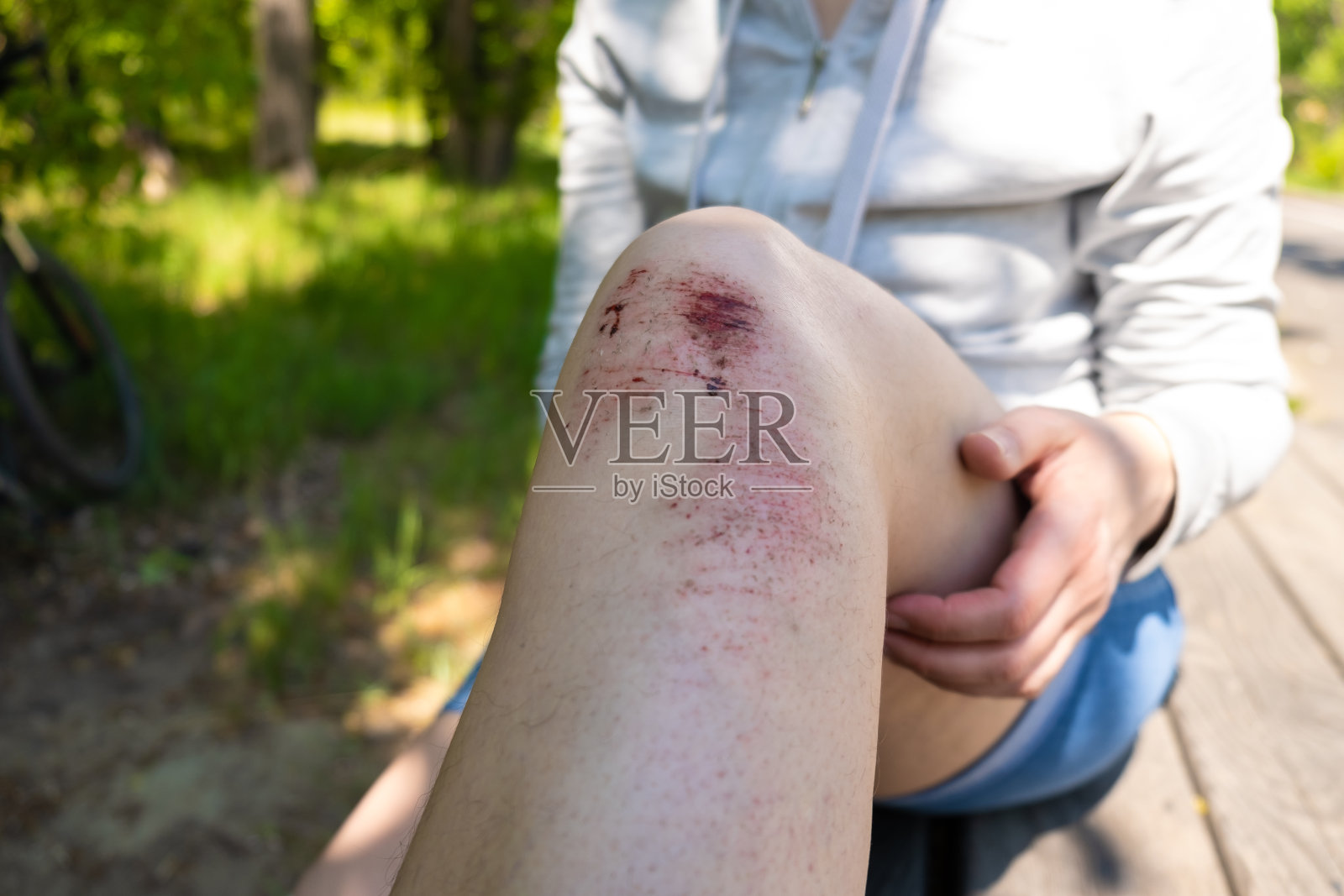 在户外活动，跑步，骑自行车时腿部受伤。膝盖上的伤口流血，皮肤清洁。有选择性的重点。照片摄影图片