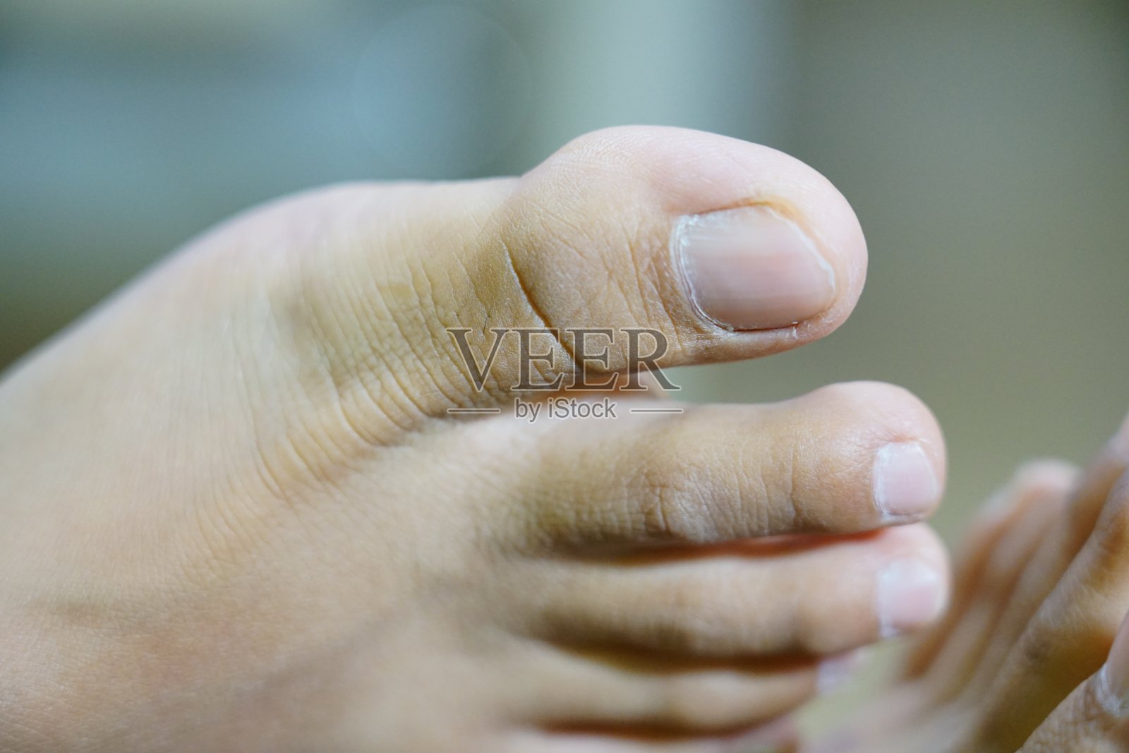 特写赤脚照片摄影图片