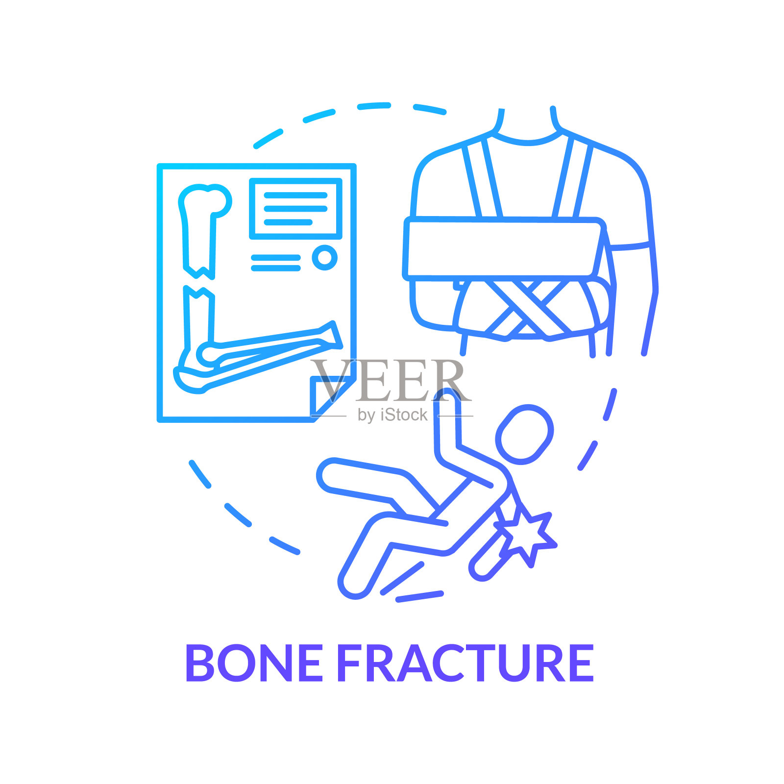 软骨骨折，骨创伤概念图标。创伤学，伤区x线诊断，治疗思路细线说明。矢量隔离轮廓RGB彩色绘图。可编辑的中风插画图片素材