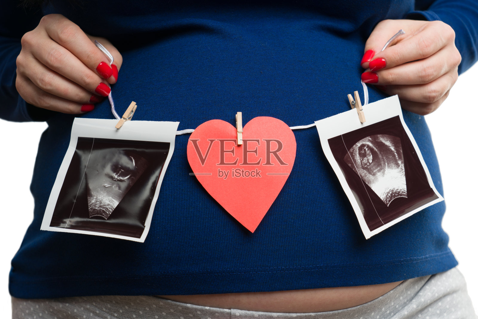 孕妇腹部超声检查照片摄影图片