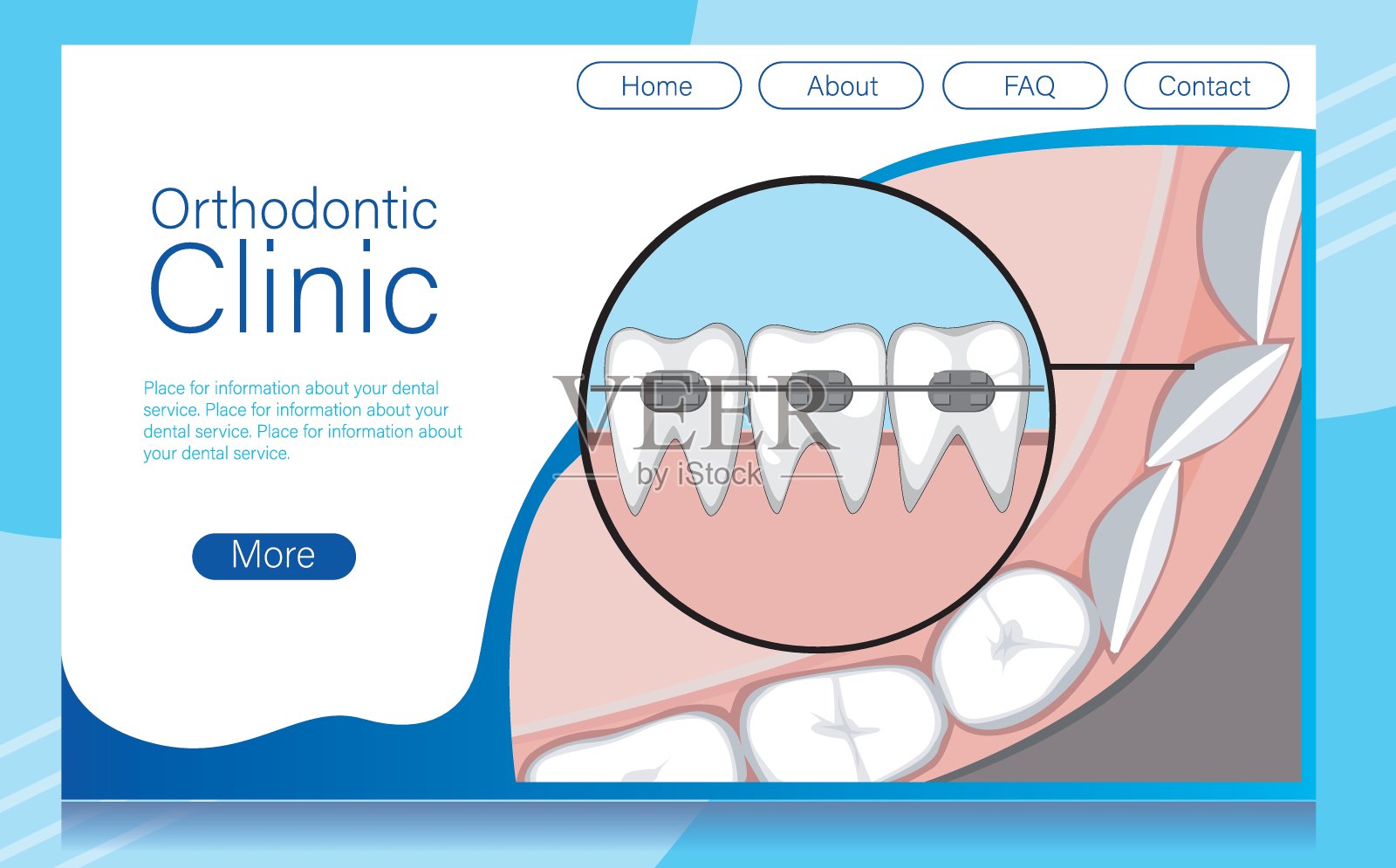 网站布局与服务安装牙套和调整牙齿，磨牙，矢量股票插图作为一个网站模板与牙套设计模板素材