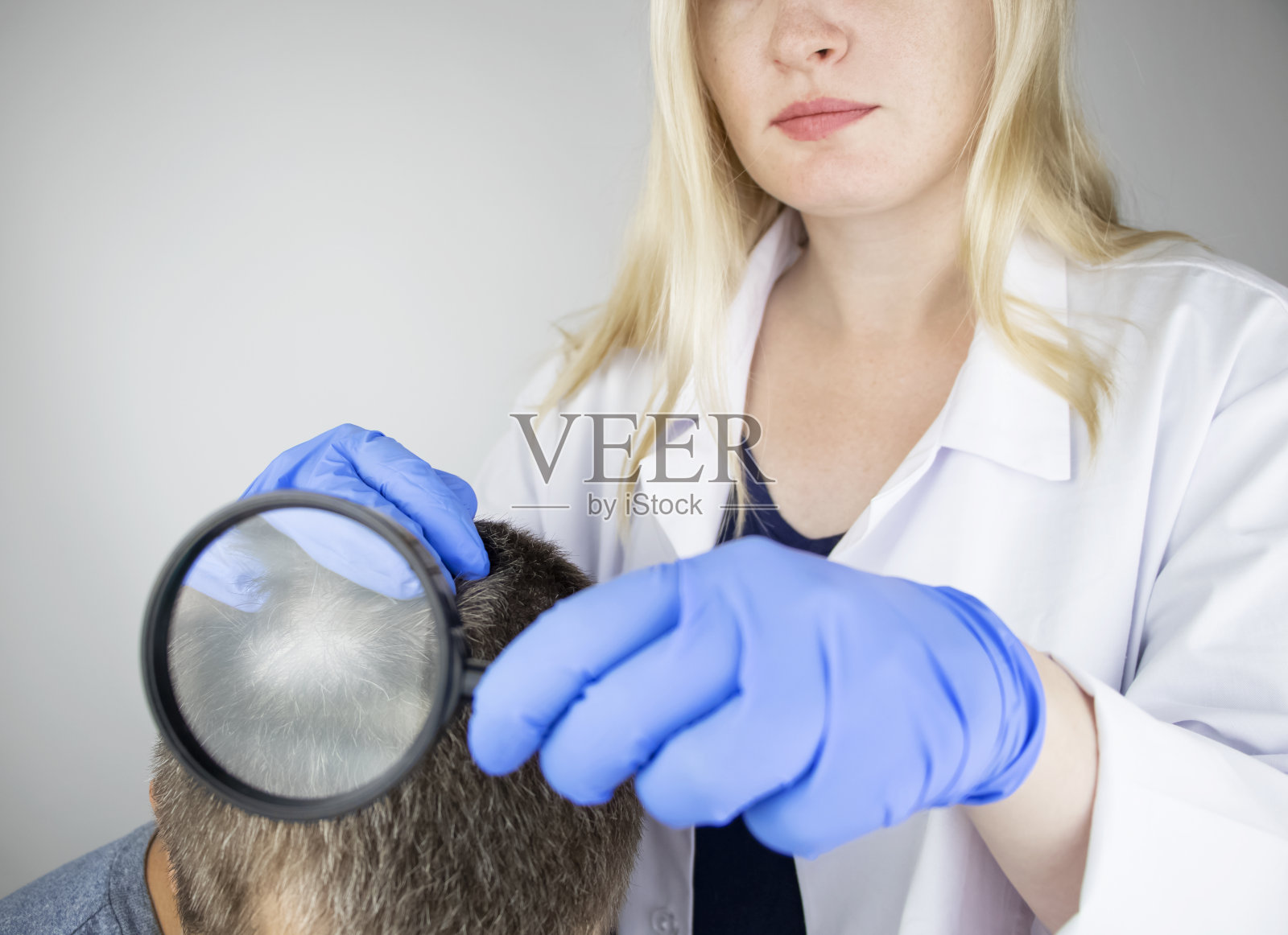 皮肤科医生检查脱发男人的头发照片摄影图片