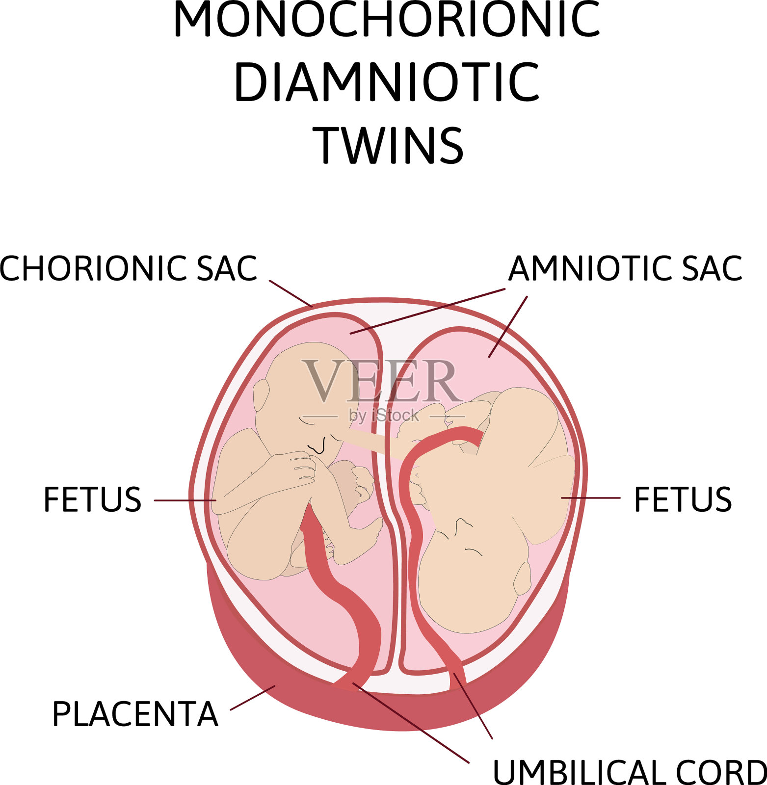 解剖腹部与双胞胎类型插画图片素材
