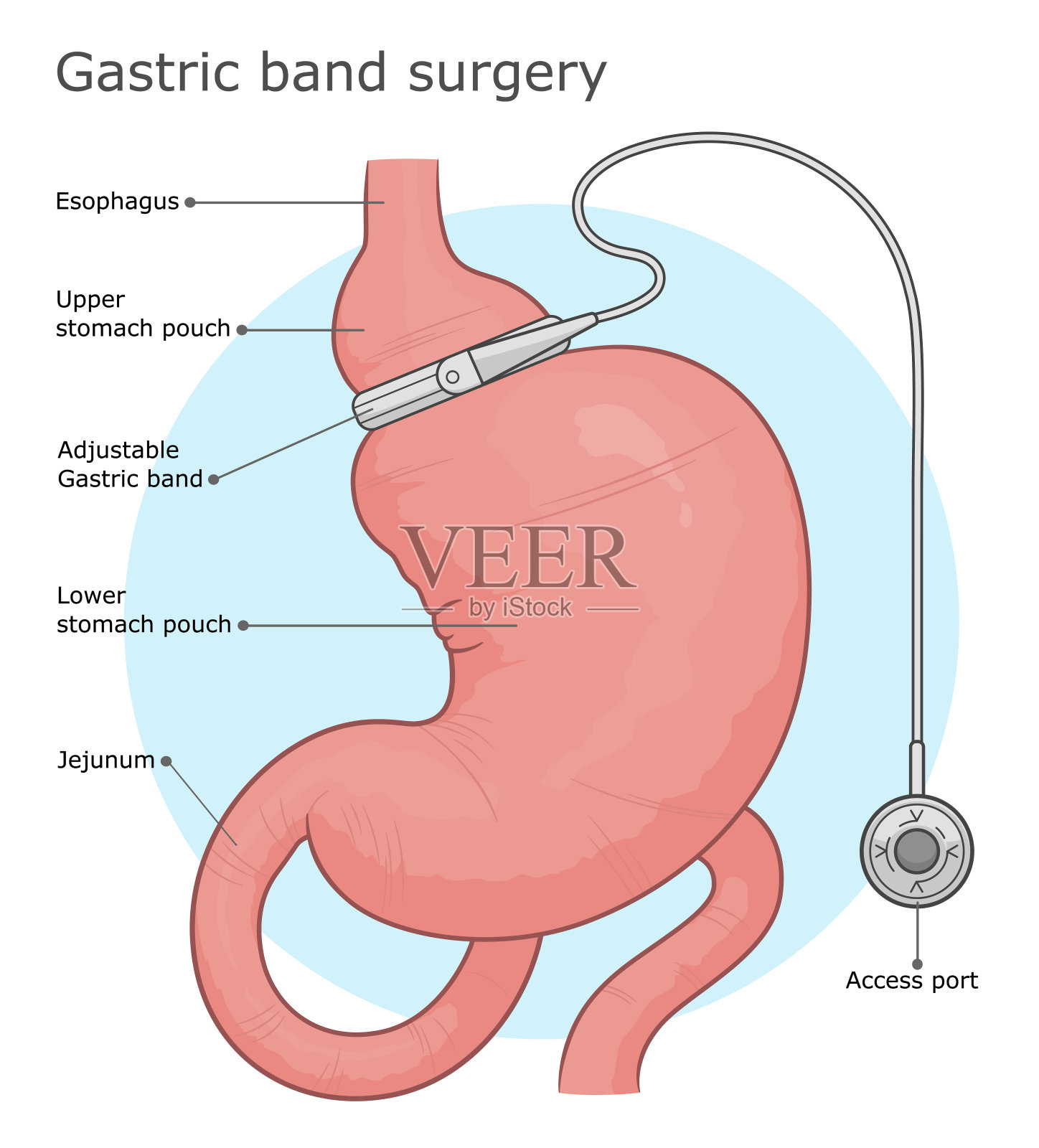 胃带插图插画图片素材